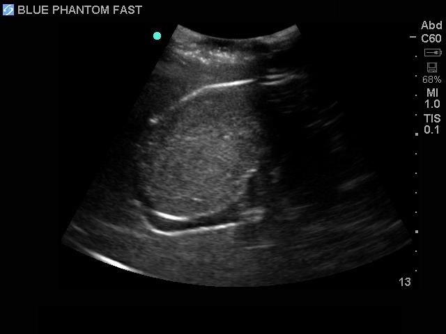 FAST Exam Real Time Ultrasound Training Model - Transthoracic Only for Emergency Medicine & Trauma Assessment Practice (Medical Simulation, Sonography Education, TTE Training)