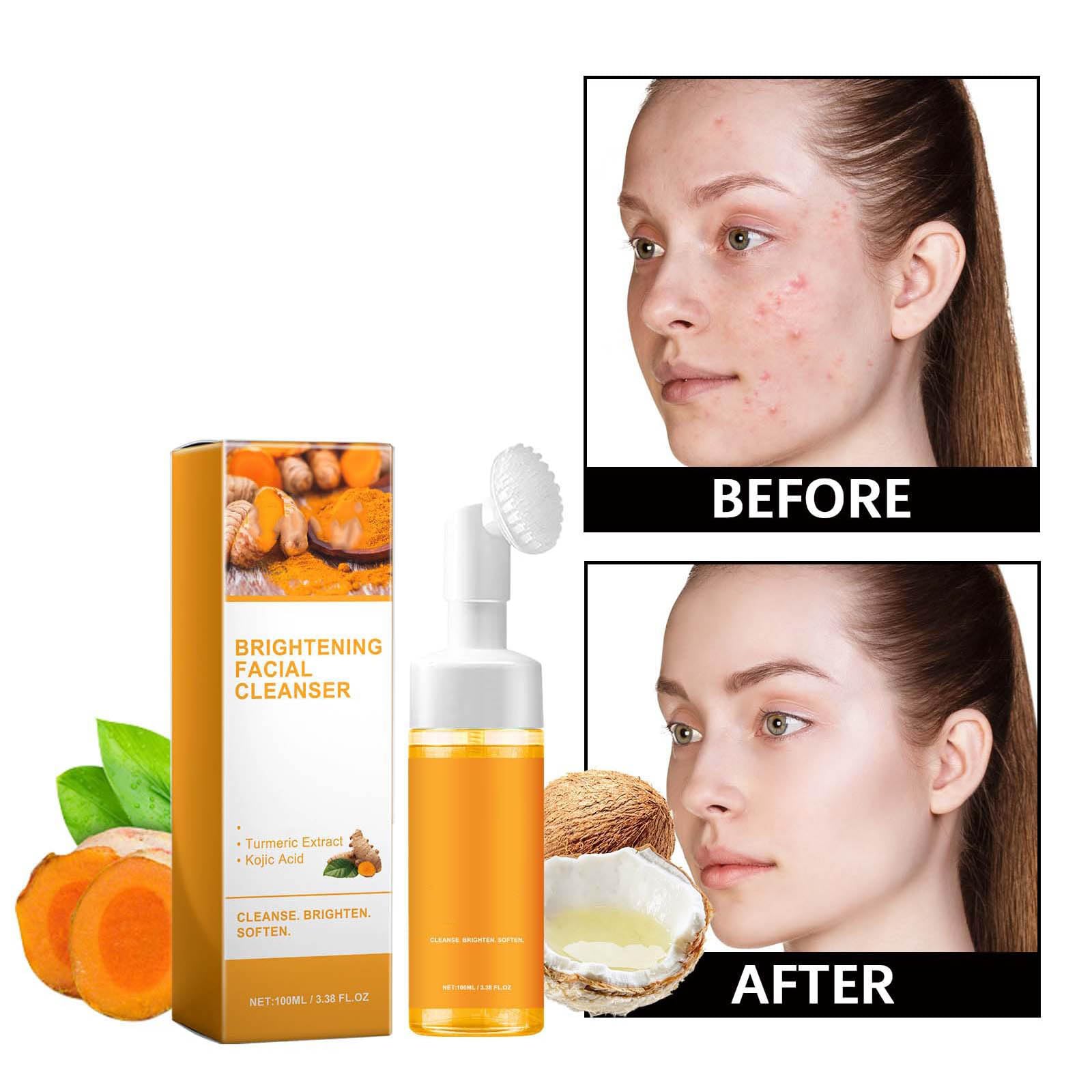Turmeric Foaming Face Wash with Brush - Deep Cleansing & Moisturizing Glow Cleanser for Acne, Dark Spots & Brightening | Daily Skincare Routine for Oily & Combination Skin