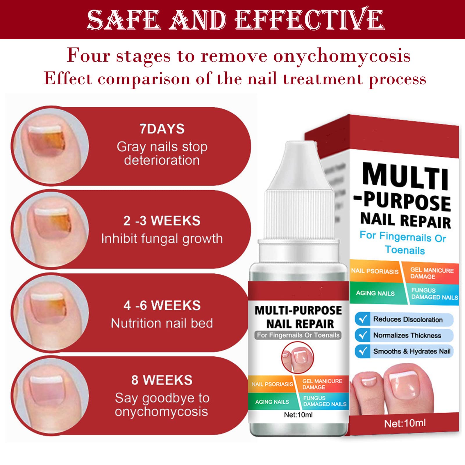 Extra Strong Fungal Nail Treatment for Toenails & Fingernails | Safe & Effective Nail Repair Lotion | Fixes Discolored & Damaged Nails | Multi-Purpose Antifungal Solution (10ML, Red) | Perfect for Athletes, Swimmers & Daily Foot Care