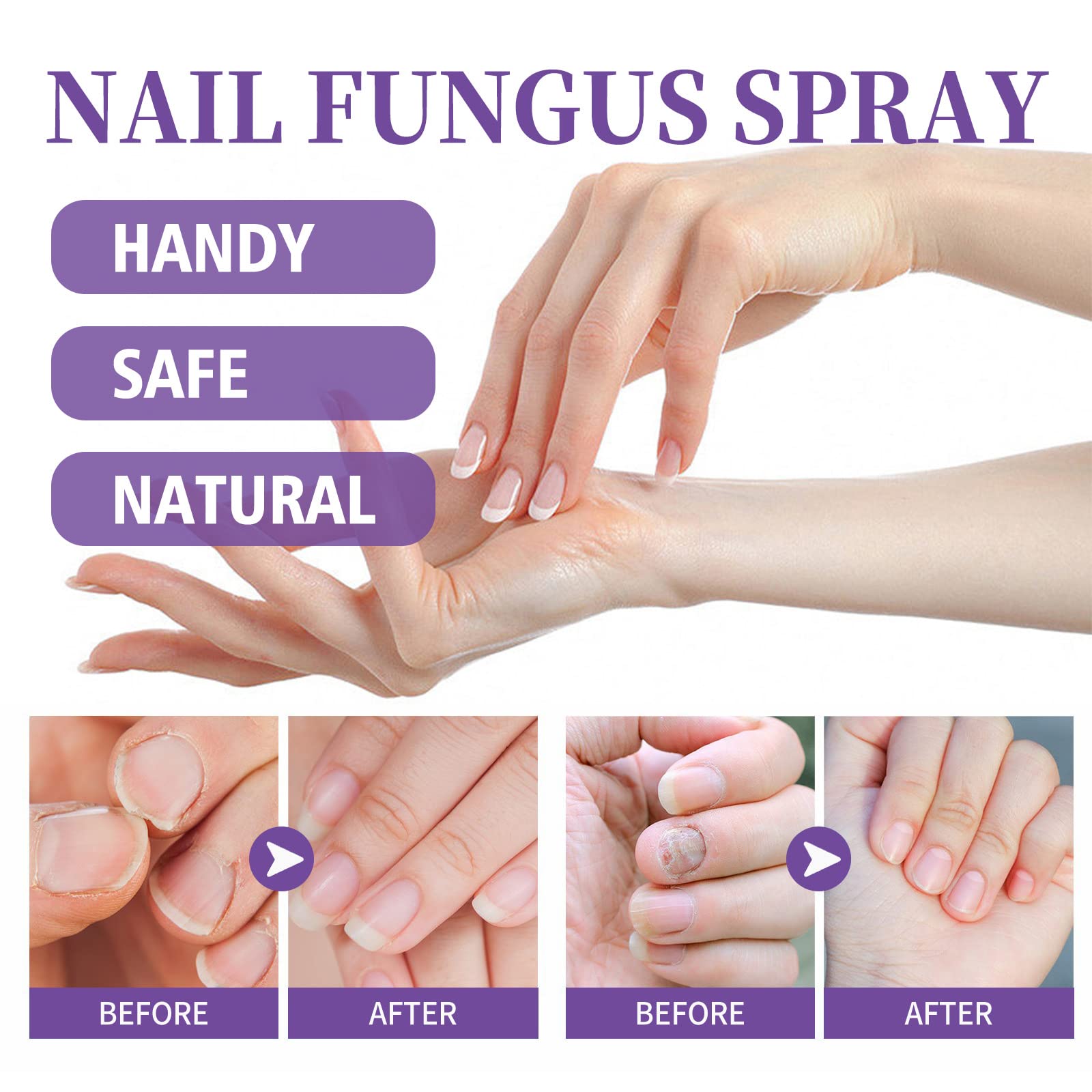 Nail Repair Essence & Treatment - Maximum Strength Nail Solution for Discolored & Damaged Nails - Restores & Strengthens Nails Fast - Perfect for Manicures, Pedicures & Nail Care Routines