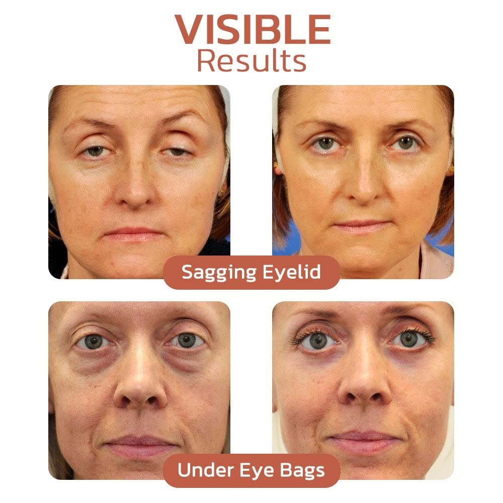 **2023 Best Peptide Lifting Eye Gel for Wrinkles, Dark Circles & Puffiness – Anti-Aging Eye Cream for Firmer Skin (3pcs) – Perfect for Night & Day Use**