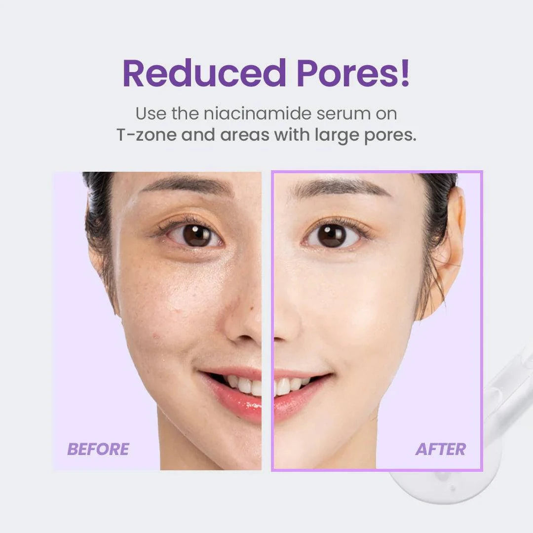 TIRTIR Niacinamide 20% Serum 30mL - Brightening & Hydrating Face Serum for Dark Spots & Acne Scars - Perfect for Daily Skincare Routine & Nighttime Use