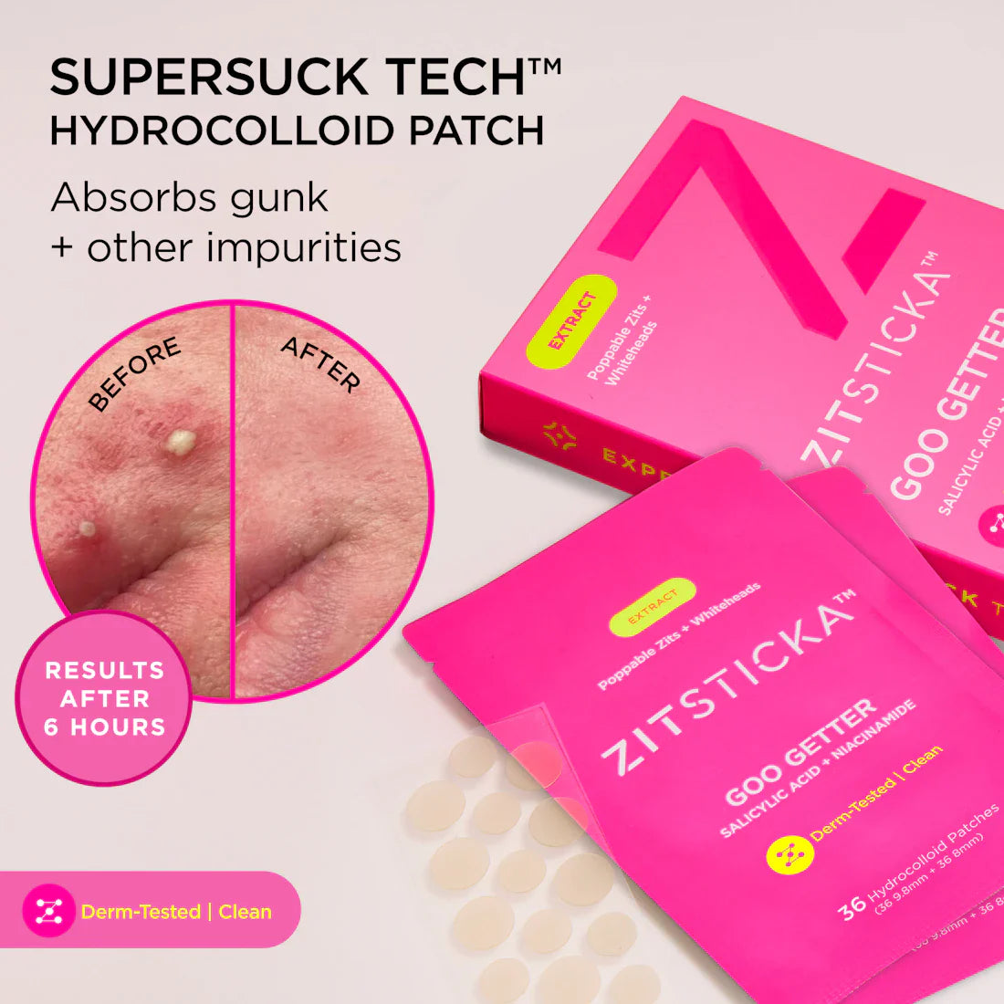 Goo Getter Hydrocolloid Acne Pimple Patches for Face - ZitSticka Spot Treatment for Breakouts, Blemishes & Zits - Perfect for Overnight Use & On-the-Go Skincare