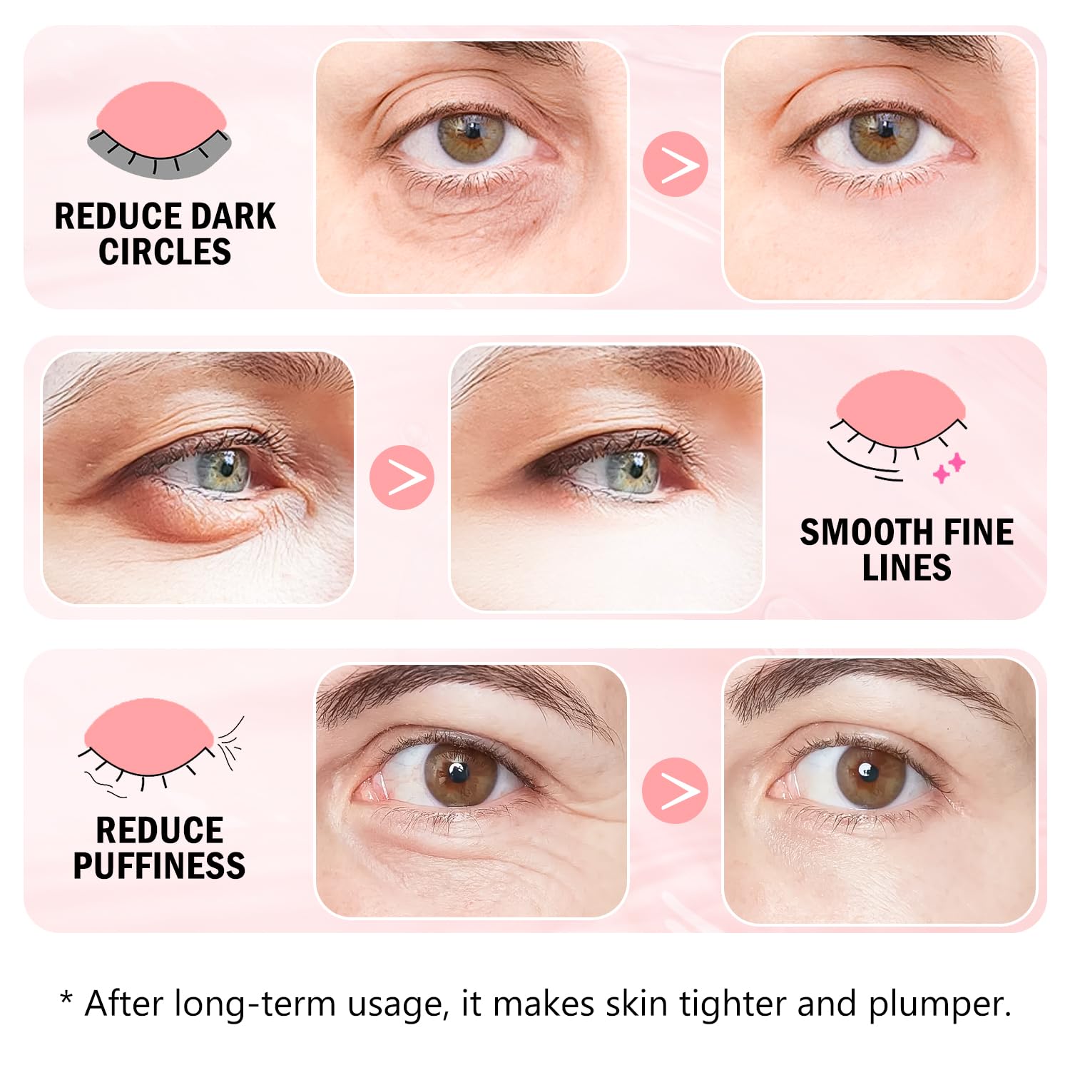 Retinol Eye Gel Pads 24 Pairs & Rose Eye Mask 30 Pairs - Collagen Under Eye Patches for Puffy Eyes, Wrinkles, Dark Circles - Anti-Aging Treatment & Face Moisturizer - Perfect for Night Routine & Travel Skincare