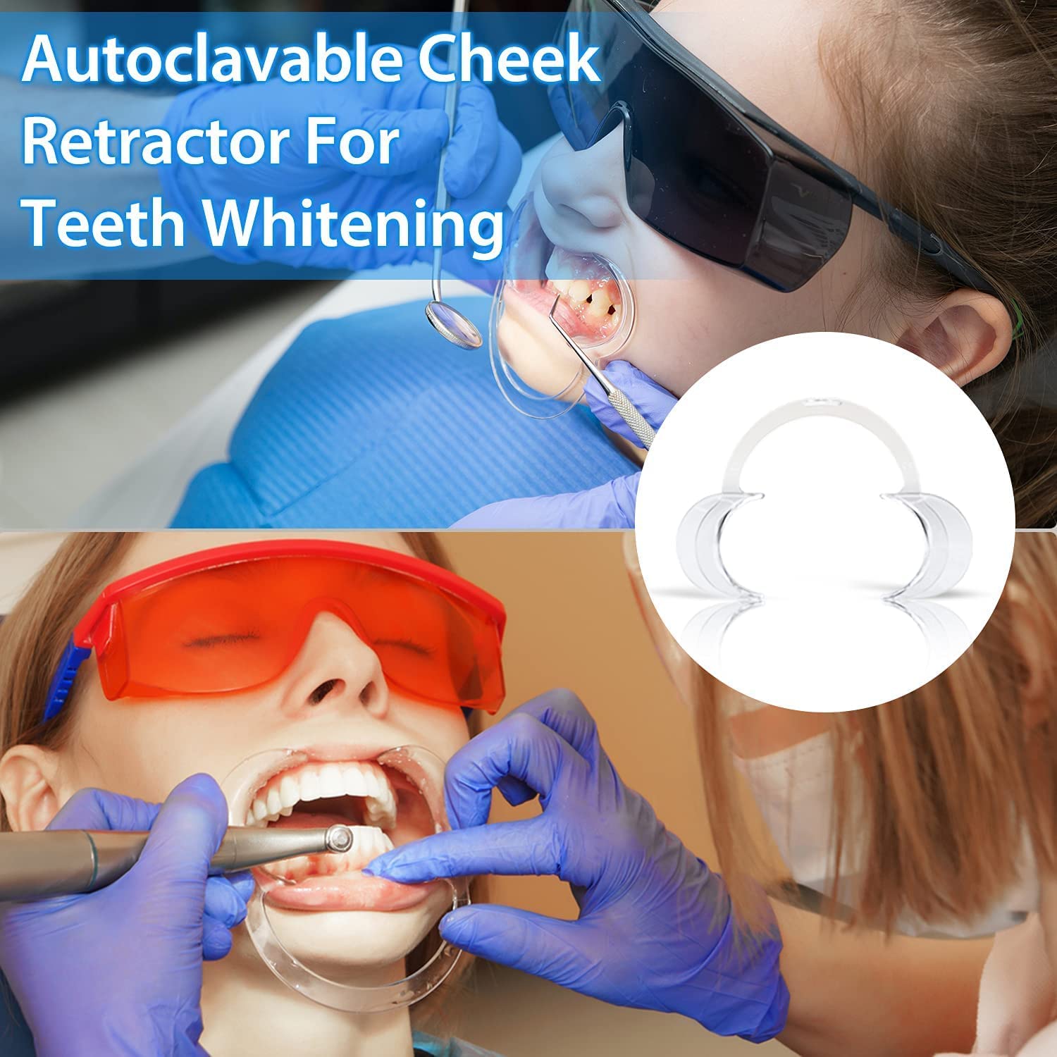 EZGO Teeth Whitening Kit - Cheek Retractor, Dental Gingival Barrier Gel & Anti-Fog Mouth Mirrors Combo for Professional & At-Home Teeth Bleaching | Includes C-Shape Mouth Opener & Gum Protector | Perfect for Dental Procedures, Whitening Treatments & Oral Care