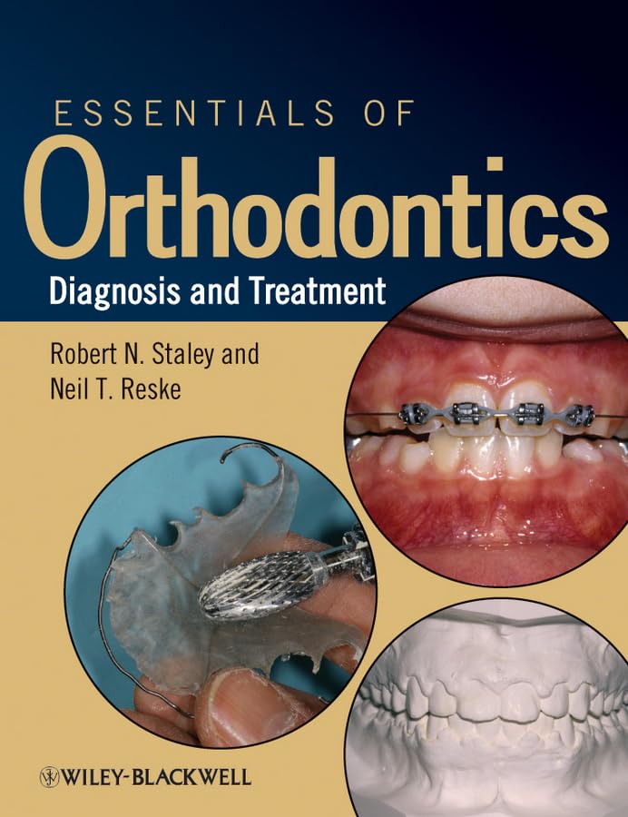 Essentials of Orthodontics: Diagnosis & Treatment Guide for Braces & Teeth Alignment | Dental Care for Adults & Teens | Perfect for Orthodontic Clinics & Home Use