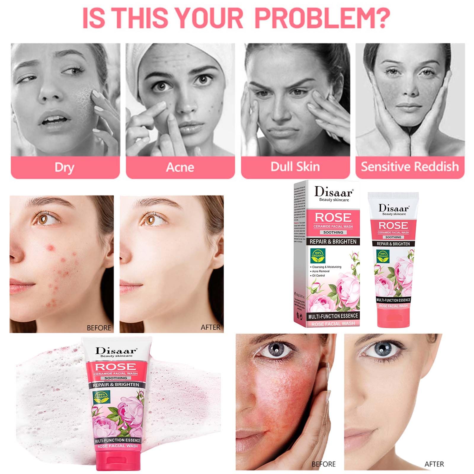 Rose Foaming Facial Cleanser with Rose Extract - Deep Cleansing & Moisturizing for Blackhead Removal, Hydrates & Balances Skin | Perfect for Daily Skincare Routine & Makeup Removal