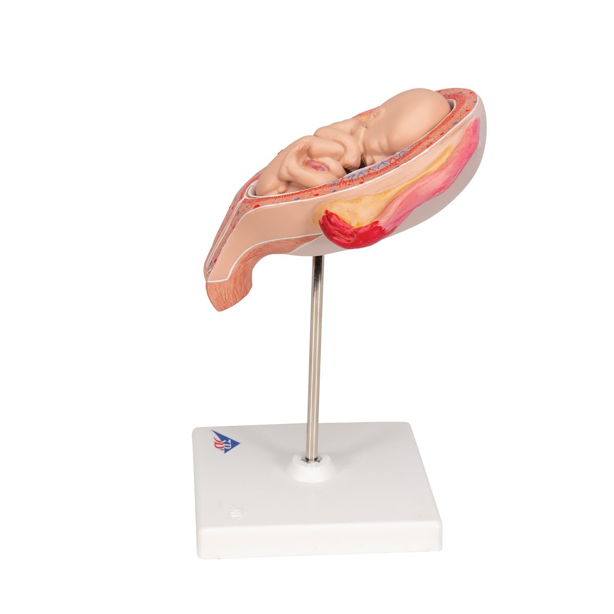 5-Month Fetus in Breech Position - Realistic Pregnancy Model for Medical Education & Training | Perfect for Obstetrics Students, Doctors & Midwives