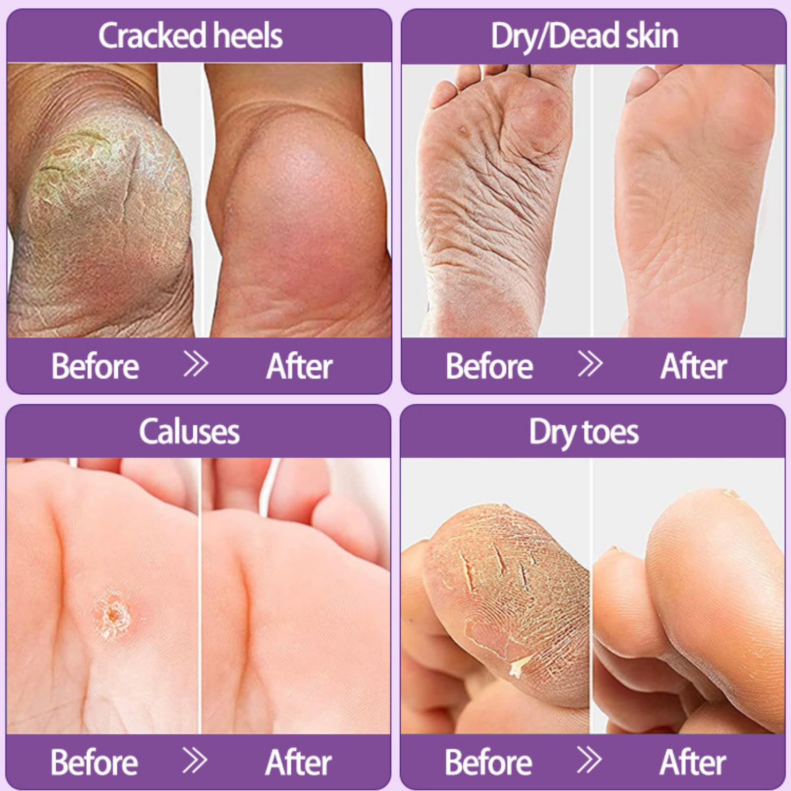3 Pairs Lavender Foot Peel Mask for Hard Skin - Moisturizing & Exfoliating Foot Mask Socks - Nourishes & Softens Feet - Perfect for Pedicures, Spa Days & At-Home Foot Care