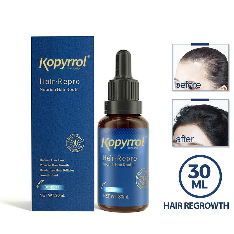 Best Hair Care Lotion for Men & Women - Strengthens Hairline & Promotes Growth | Daily Use for Thicker, Healthier Hair