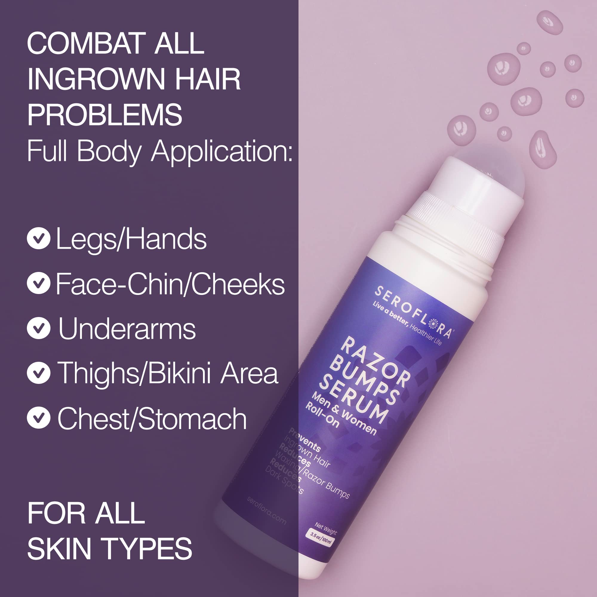 Acne & Razor Bump Treatment Cream - Pimple, Zit & Ingrown Hair Serum for Bikini Area | Post-Shave & Waxing Soothing Solution | Perfect for Sensitive Skin Care & Body Grooming