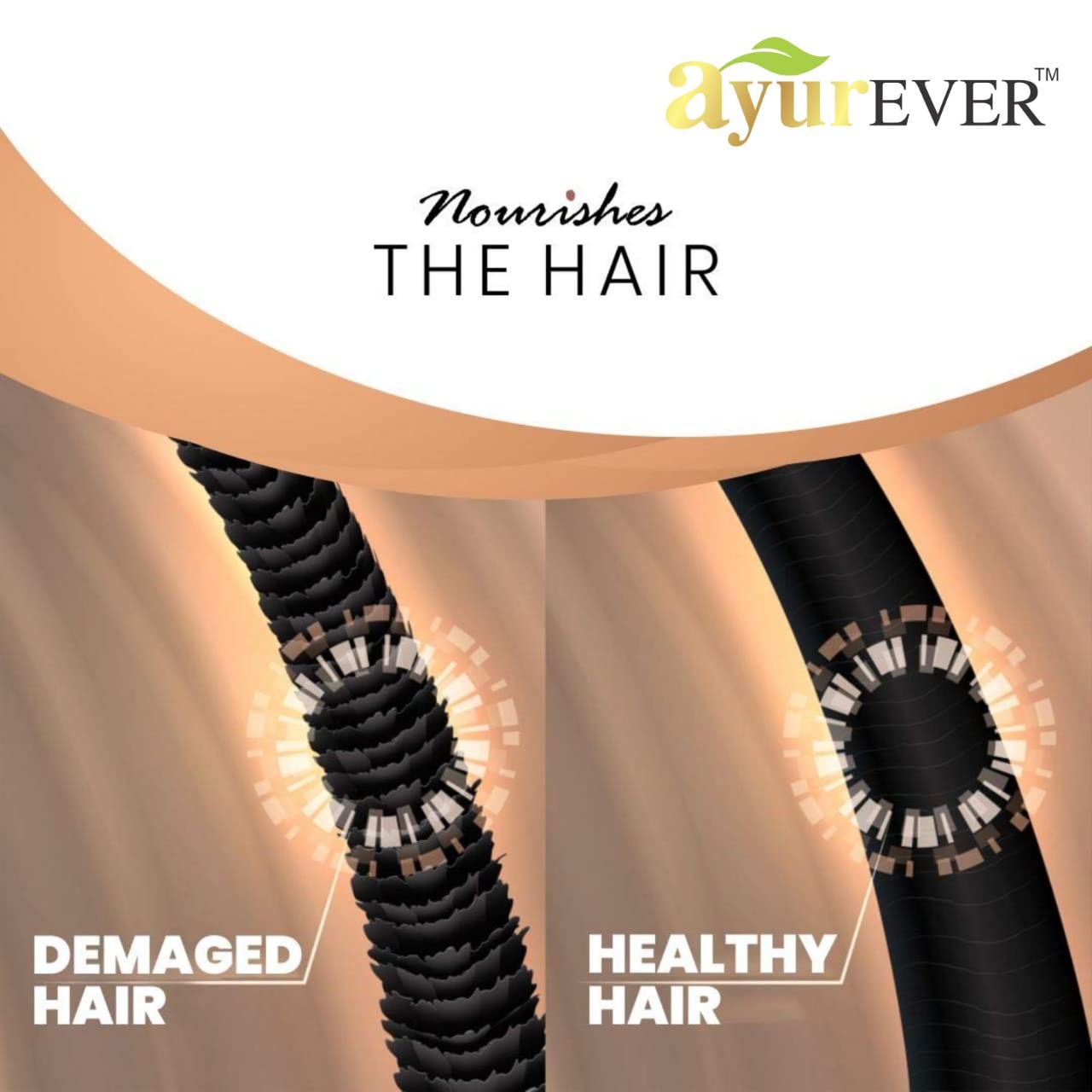 AYUREVER Onion Shampoo for Hair Growth & Dandruff Control - 300ml Sulfate-Free Hair Care for Stronger, Healthier Hair - Perfect for Daily Use & Scalp Treatment