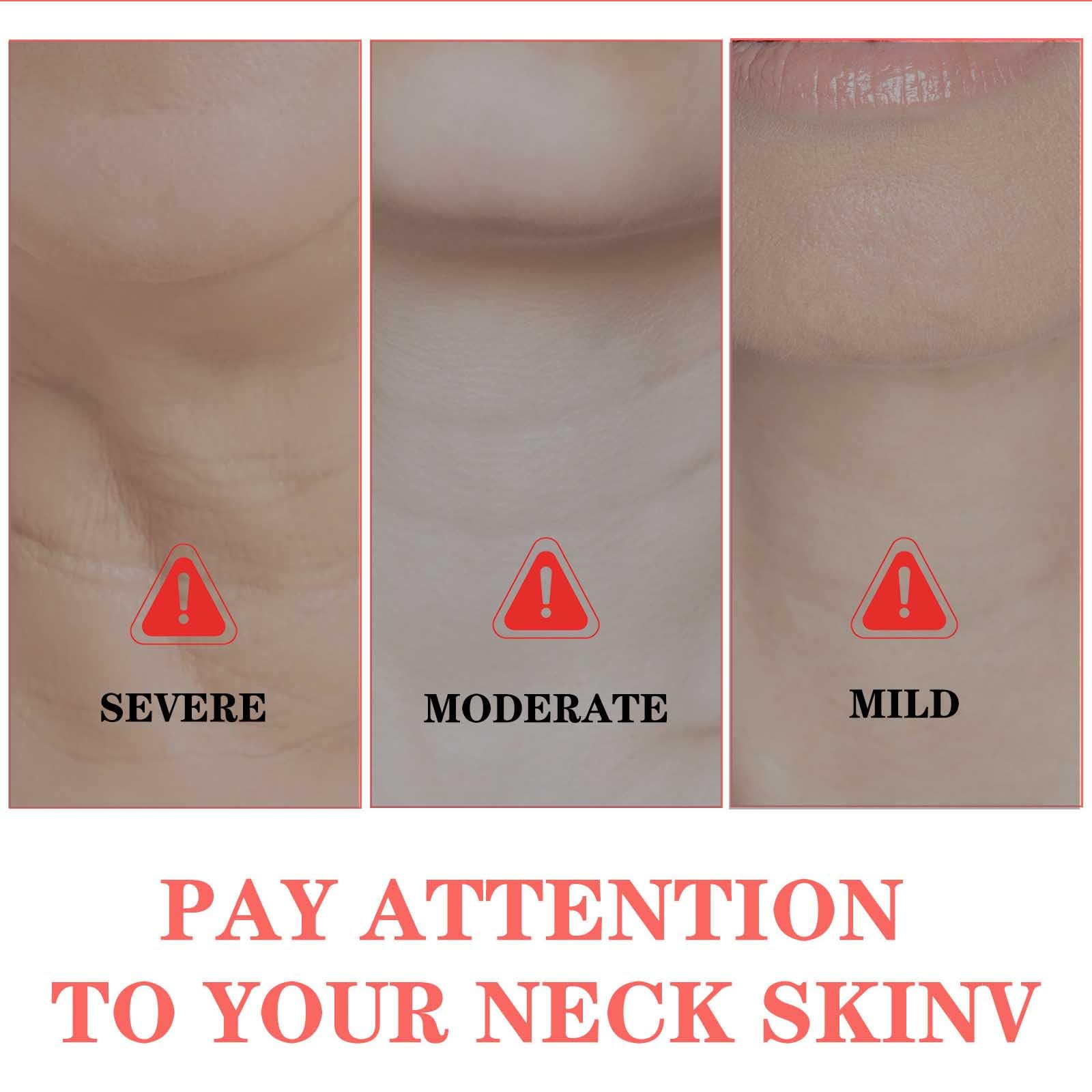 Hibiscus Honey Neck Firming Cream - Reduce Lines & Lift Skin for Daily Care