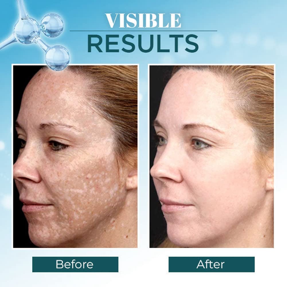 Dark Spot Corrector for Face & Body - Natural Pigmentation Treatment with Cruelty-Free Ingredients | Brightening Serum for Women (30g) | Perfect for Daily Skincare Routine & Hyperpigmentation Care