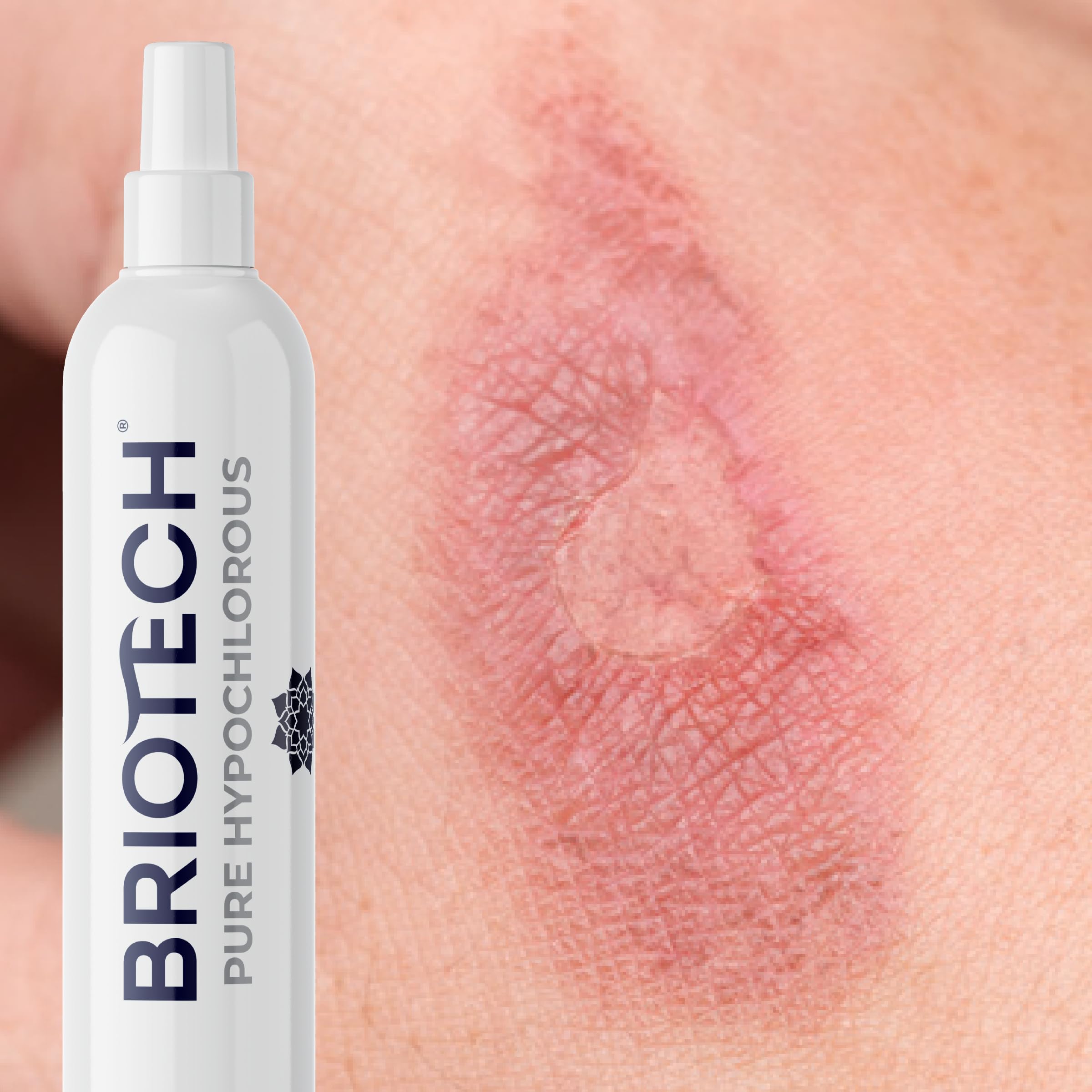 BRIOTECH Pure Hypochlorous Acid Cleaner | Premium HOCl Topical Solution | Multi-Purpose Disinfectant for Home, Skin & Pets | 1 Gallon Refill | Safe for Family & Pet Use | Ideal for Wound Care, Surface Cleaning & Air Purification