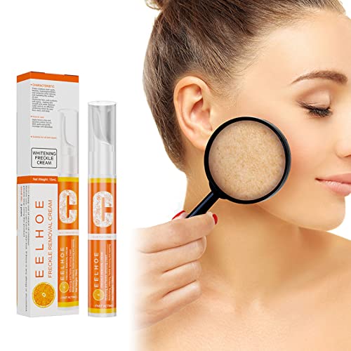 Best Dark Spot Remover Cream for Face - Hyperpigmentation Treatment for Women & Men | Fades Dark Spots, Melasma, Freckles & Sun Damage | Brightening Skincare for Day & Night Use