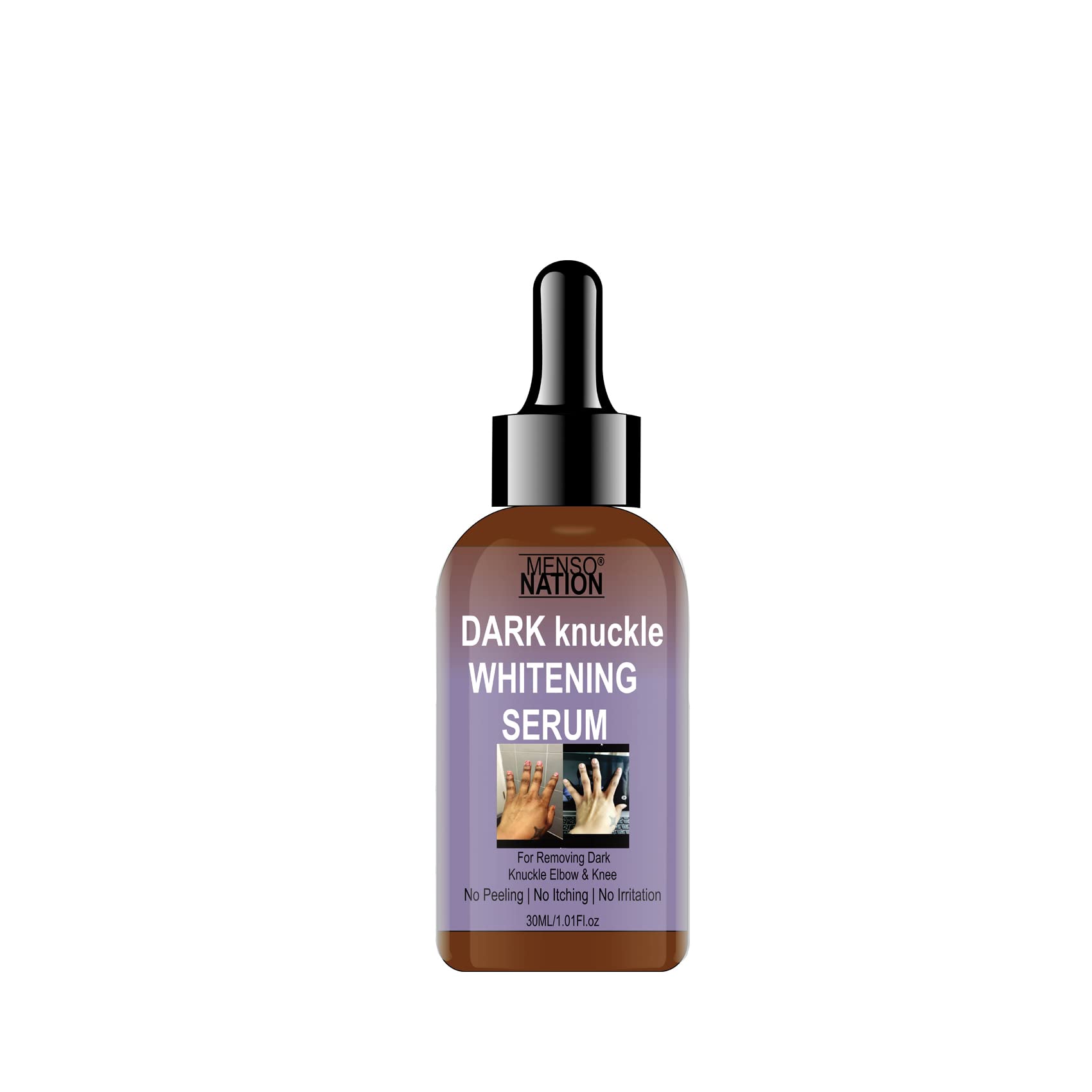 Mensonation Fast-Acting Whitening Serum for Dark Knuckles, Elbows & Knees - 30ml (2-Pack) | Brightens & Evens Skin Tone | Perfect for Dry, Rough Areas & Post-Sun Care