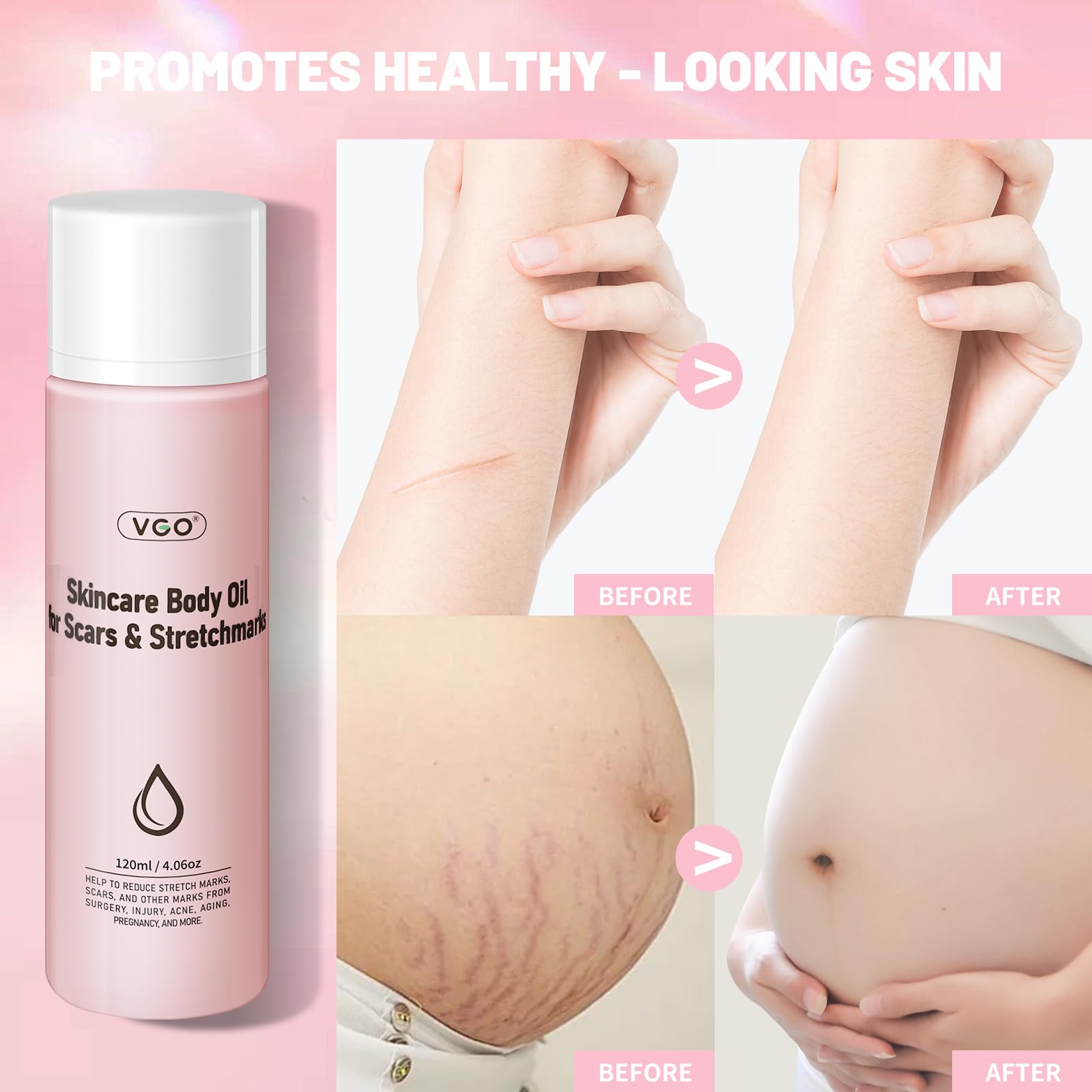 VGO Skincare Body Oil with 92% Snail Mucin - Deep Moisturizing & Hydrating for Dry Skin - Perfect for Daily Use, Post-Shower & Nighttime Skincare Routine