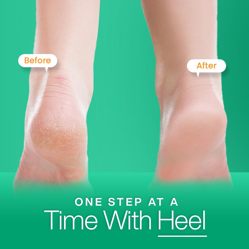 Stepify Silicone Heel Pads for Pain Relief - 3 Pack Gel Cushion Inserts for Women & Men, Breathable Soft Heel Support Socks, Comfortable Foot Care Solution for Heel Spurs, Plantar Fasciitis - Perfect for Running, Walking, Work & Daily Activities