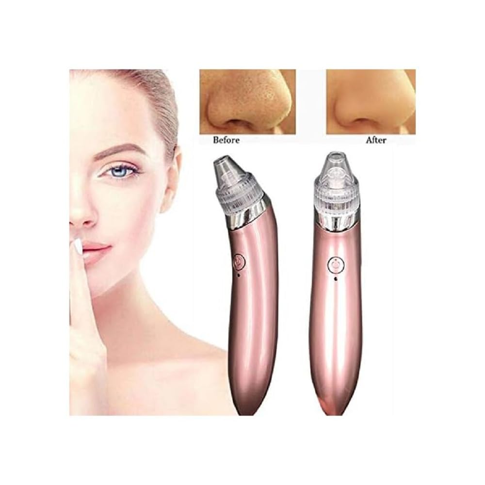 Twiclo Blackhead Remover Vacuum Kit - Professional Acne Treatment & Pore Cleaner for Beautiful Skin | 1 PC | Perfect for Daily Skincare Routine & Spa Treatments