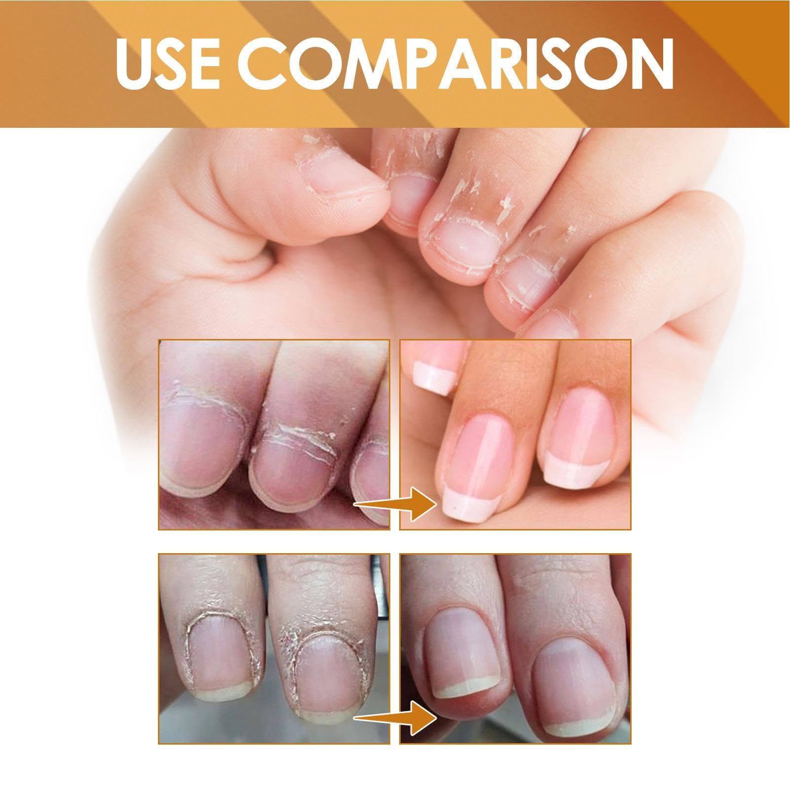 Cuticle Remover Gel - 1oz Instant Nail Strengthening & Exfoliating Treatment | 15-Second Nail Care Solution for Hands & Feet | Perfect for Salon & At-Home Manicures