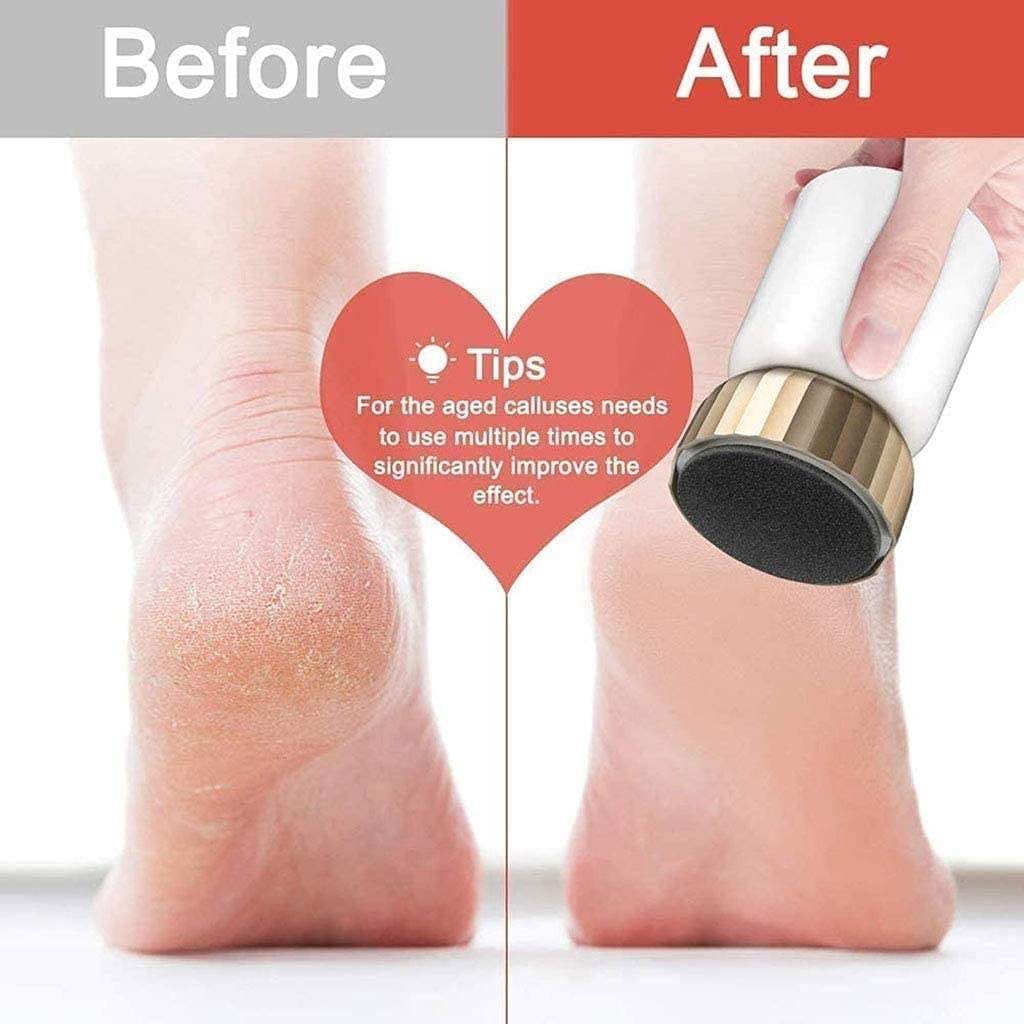 Electric Foot Grinder & Callus Remover – Portable Pedicure Tool for Cracked Heels, Dead Skin & Dry Feet – Rechargeable Foot Sander for Smooth Soft Skin | Perfect for Home Spa, Travel & DIY Foot Care (White)