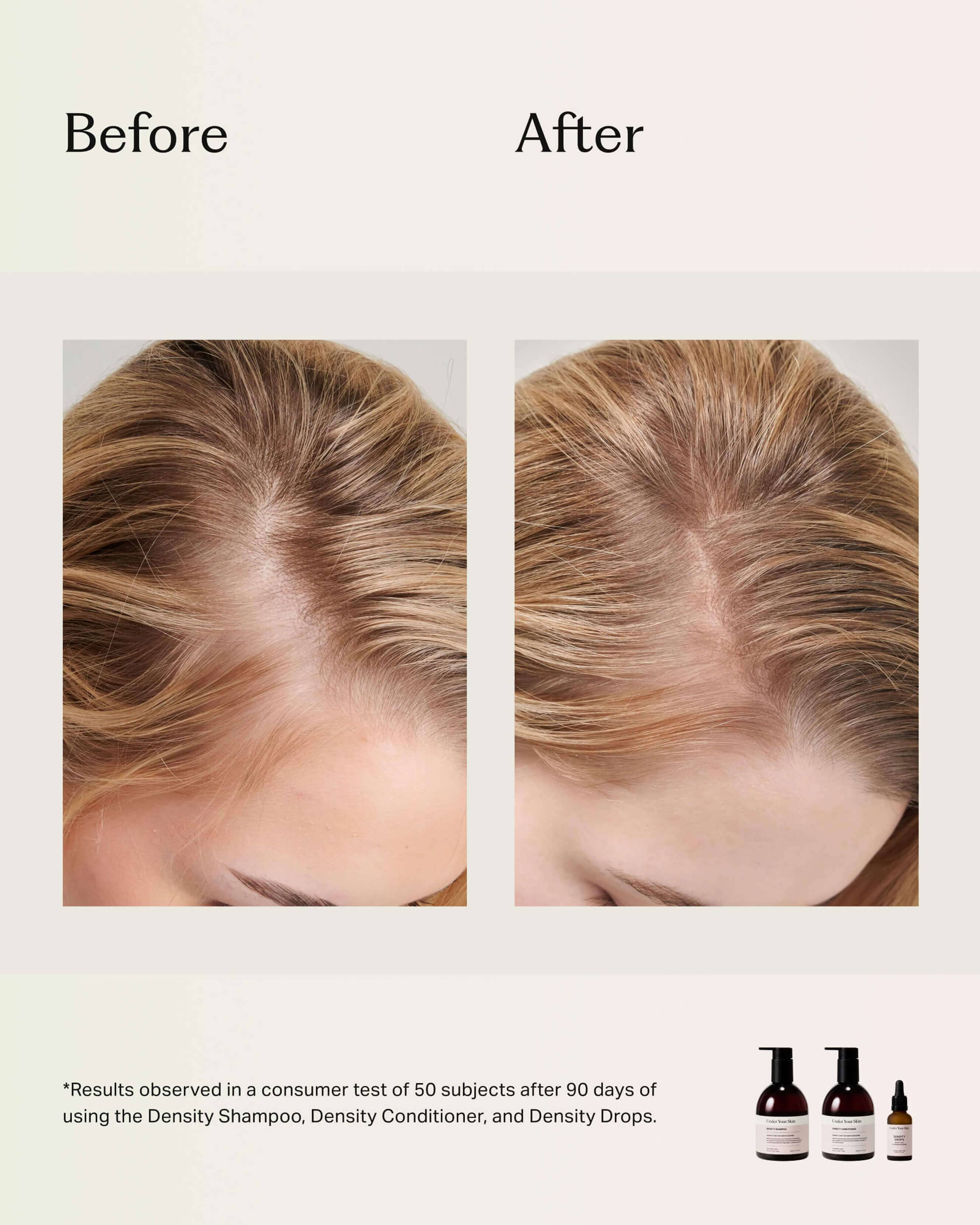 Premium Hair Density Conditioner for Thinning Hair - Volumizing & Thickening Treatment for Fine, Thin Hair - Perfect for Daily Use & Hair Growth Care