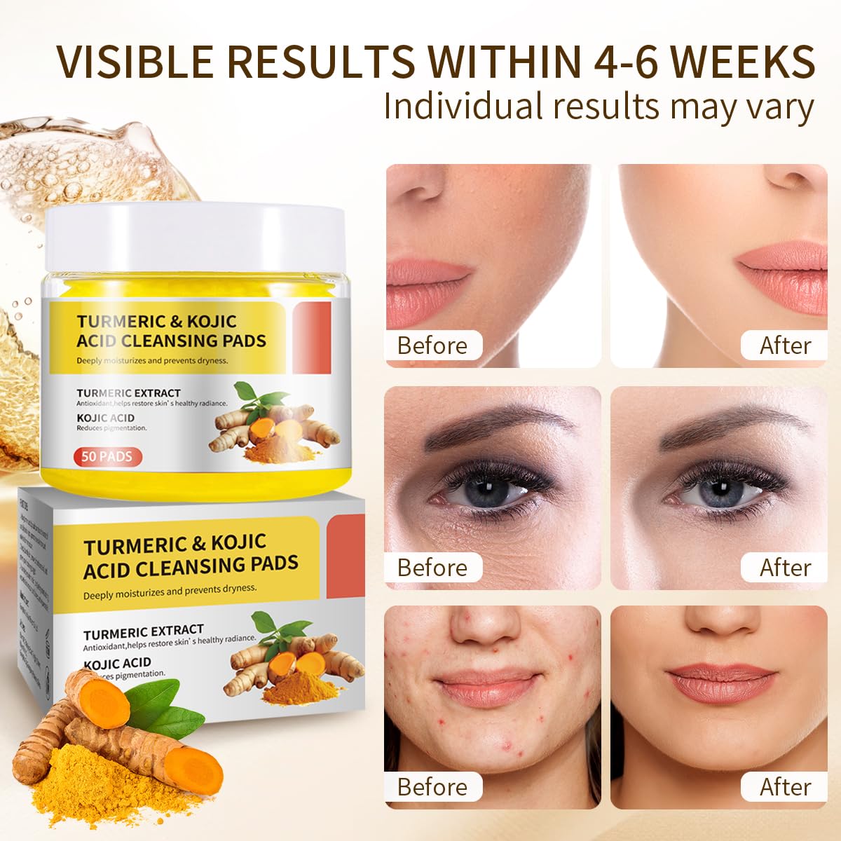 Turmeric & Kojic Acid Cleansing Pads for Dark Spots - Brightening Face Scrub Pads with Natural Ingredients for Acne & Hyperpigmentation | Daily Skincare Routine for Glowing Complexion