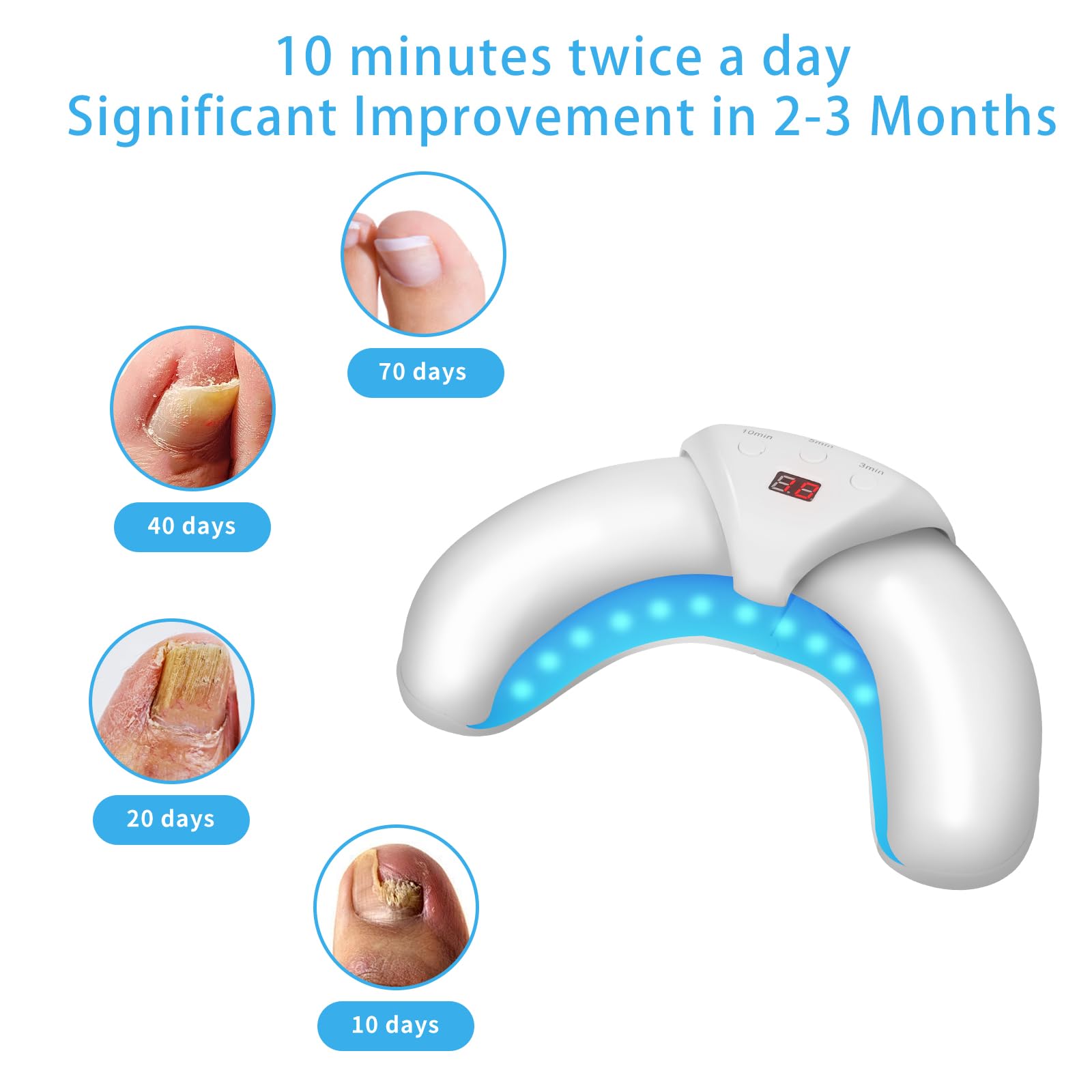 Blue Light Therapy for Nail Fungus Treatment - 470nm & 910nm Infrared LED Device for Thick, Discolored & Damaged Nails - At-Home Podiatry Care Solution for Toenail & Fingernail Health