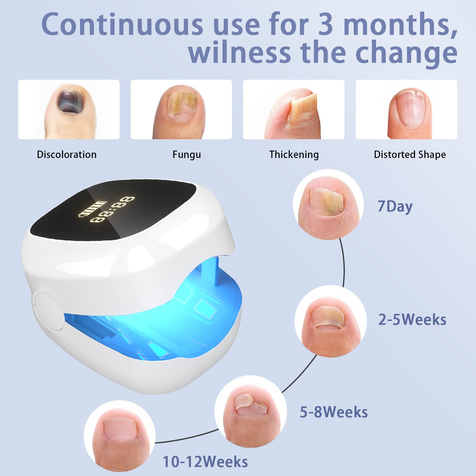 Professional Nail Fungus Laser Treatment Device with LED Light - Effective for Toenail & Fingernail Fungal Infections, Improves Nail Health, Reduces Deformation & Pain - Portable Home Use for Athletes, Seniors & Diabetics (White)