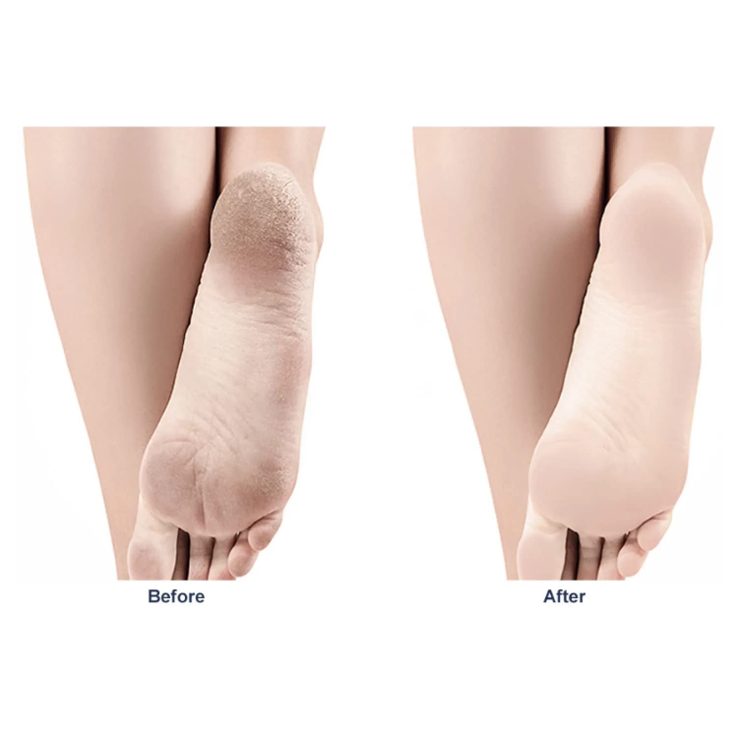 Niralasa Nano Glass Foot Grinding Stone - Exfoliating Callus Remover for Cracked Heels & Dead Skin | Perfect for Pedicures & At-Home Foot Care