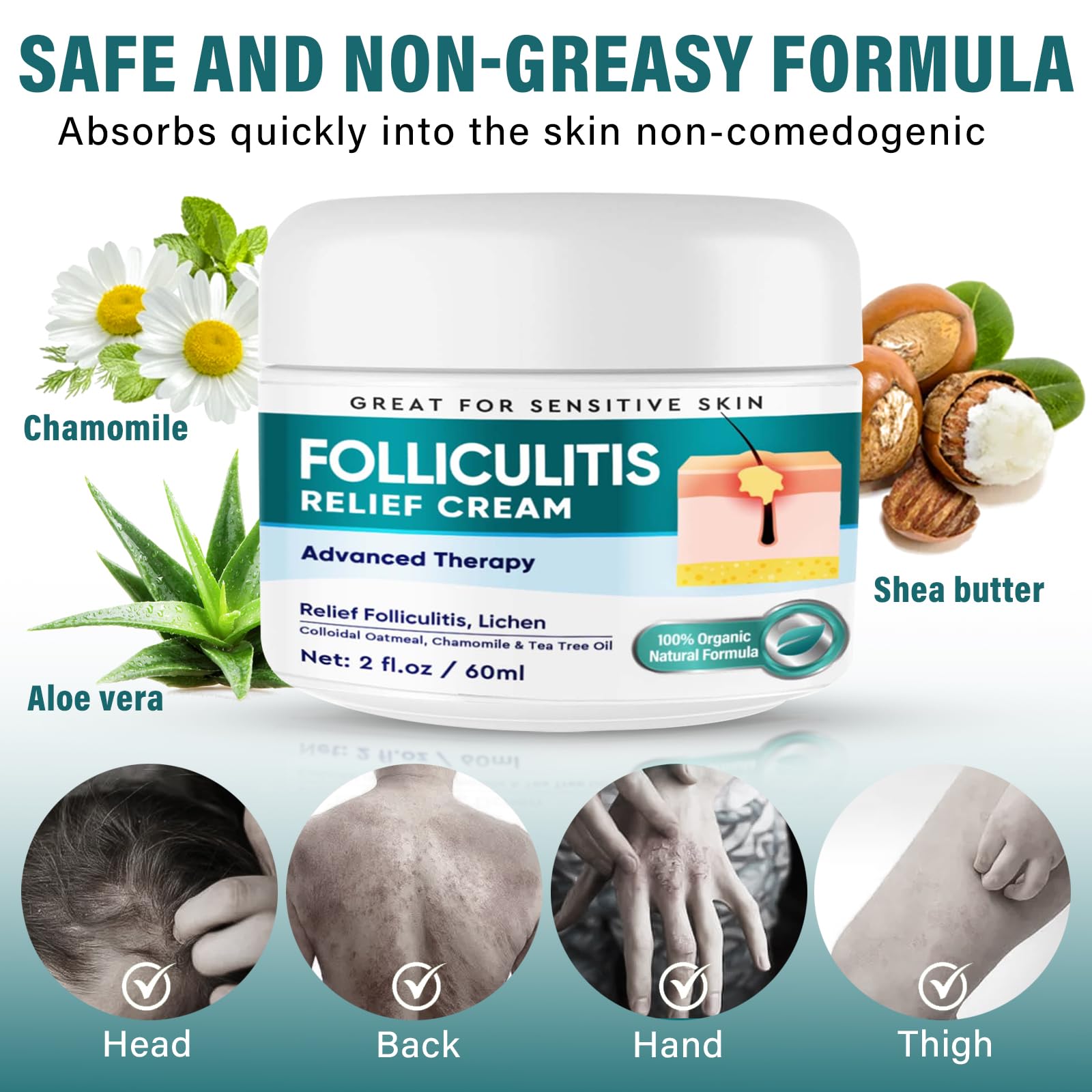 Dijkoo Folliculitis Treatment Cream for Face & Body - Severe Bumps & Irritation Relief for Men & Women - 60g - Soothes Razor Burns, Ingrown Hairs & Skin Inflammation | Perfect for Post-Shaving & Hair Removal Care