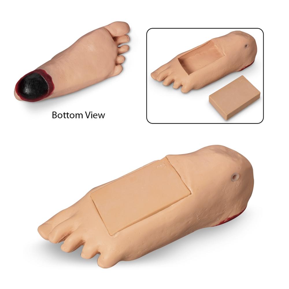 GERi™ KERi™ Edema Relief Socks for Swollen Feet with Tissue Damage - Light Skin Tone - Comfortable Compression for Lymphedema, Post-Surgery & Diabetic Foot Care