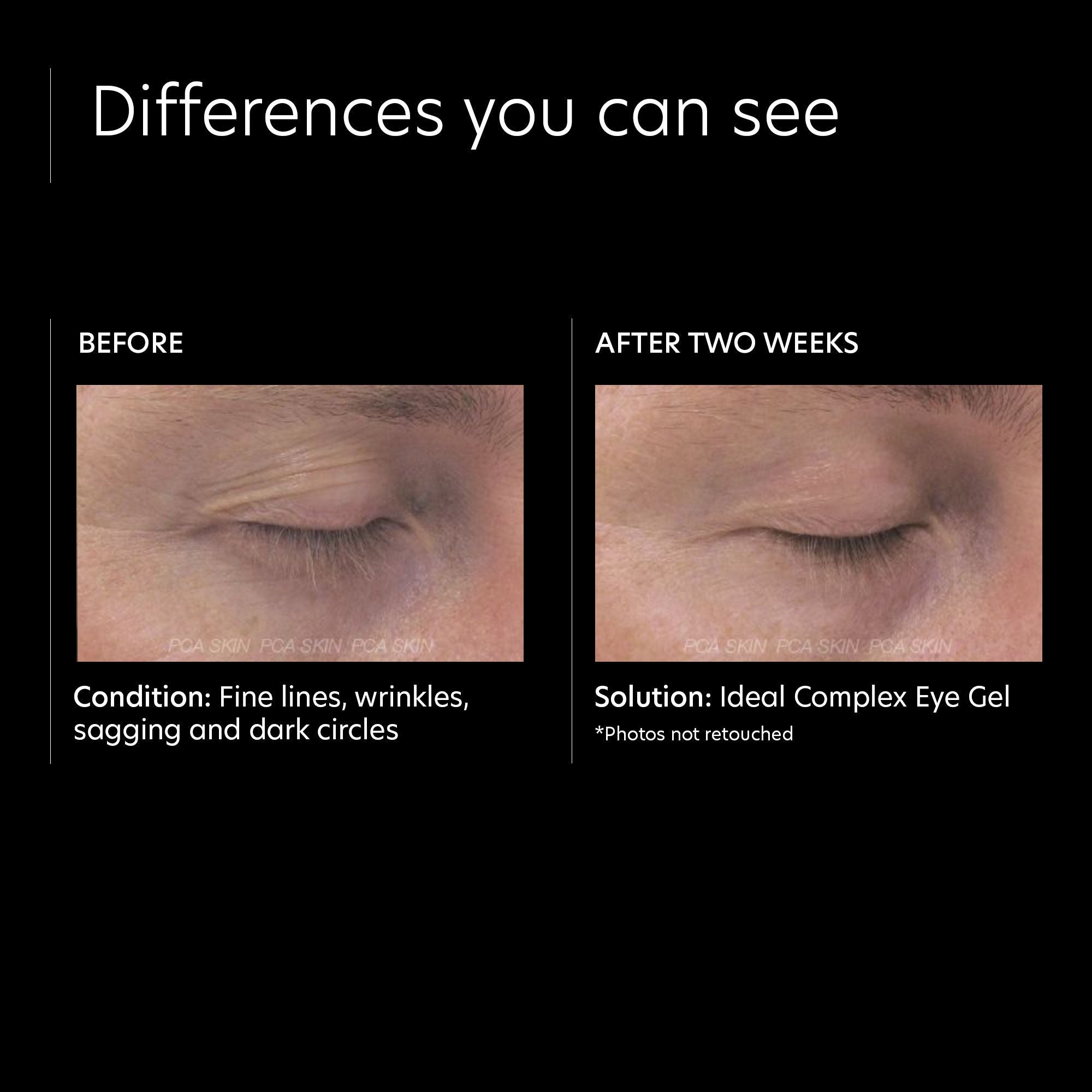 Ideal Complex Revitalizing Eye Gel for Dark Circles & Puffiness - Anti-Aging Eye Treatment for Wrinkles & Fine Lines - Perfect for Morning & Night Skincare Routine