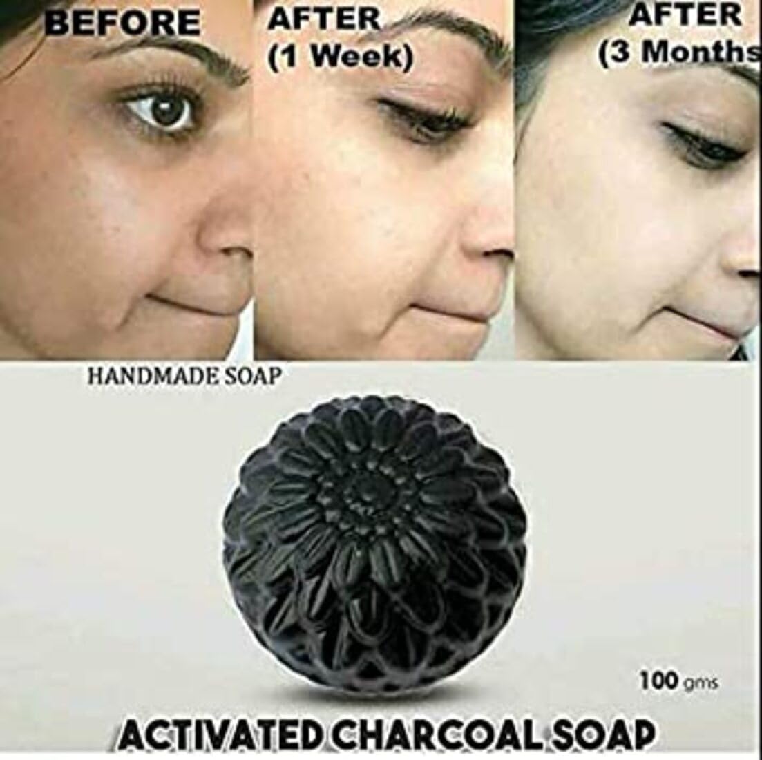 Charcoal Bath Soap for Face & Body - Deep Cleansing, Skin Brightening & Whitening, Removes Dirt & Germs - Set of 6 Bars for Acne-Prone & Oily Skin - Perfect for Daily Skincare Routine & Spa Days