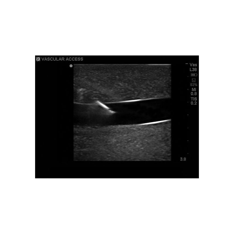 Gen II Central Line and Regional Anesthesia Replacement Insert - Sterile Medical Catheter for IV Therapy & Pain Management in Hospitals & Clinics