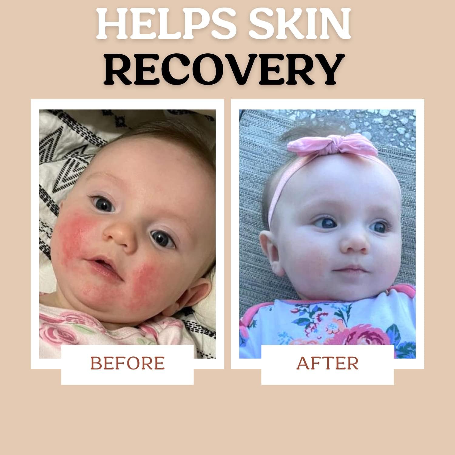 Power Pair Probiotic Baby Power Serum & Biome Barrier Cream - Hydrating, Soothing Skincare Set with Clean Ingredients for Sensitive Skin | Safe for Babies & Adults | Perfect for Dry Skin Care & Eczema Relief