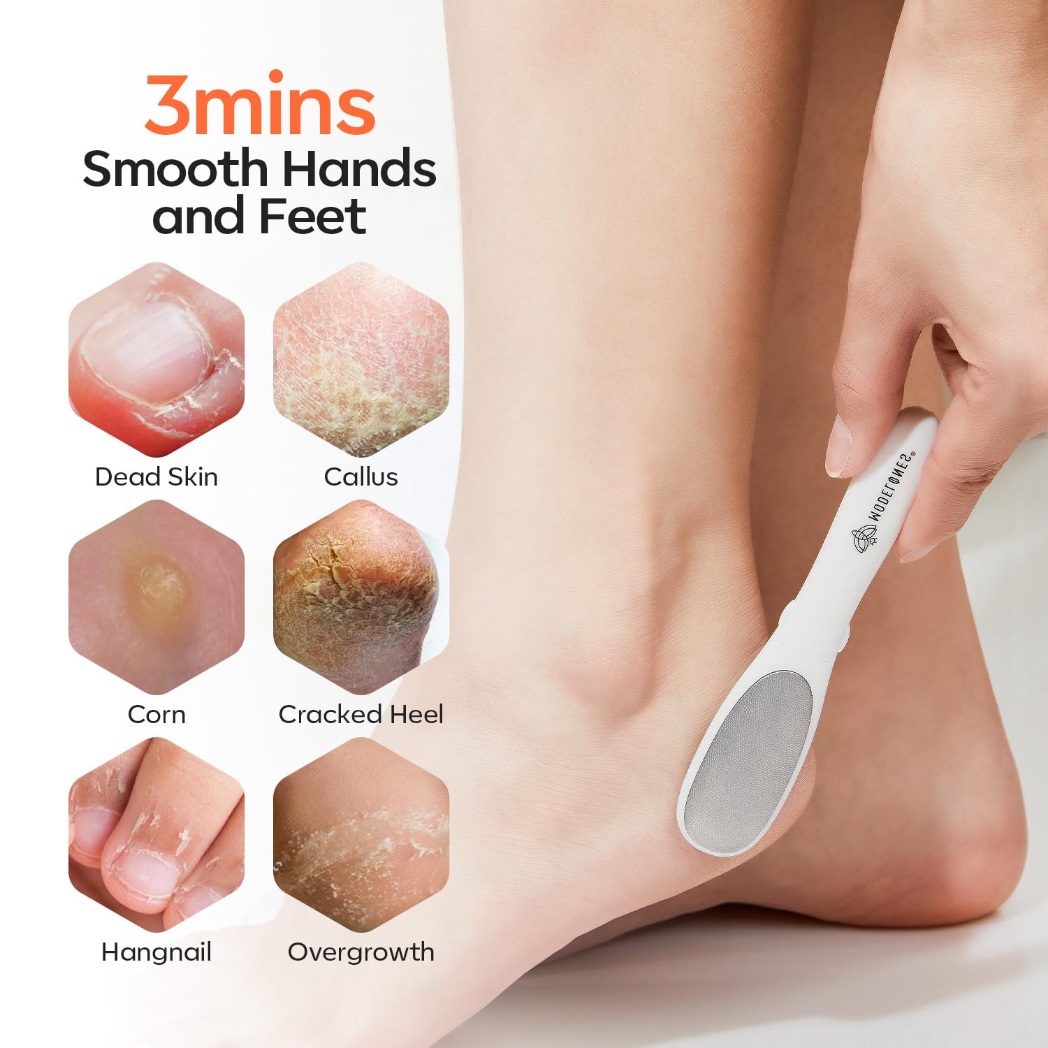 Modelones Mini Foot File Callus Remover - 2-in-1 Pedicure Tool with Double-Sided Foot Rasp & Dead Skin Fork - Safe & Lightweight Foot Sander for Smooth Feet - Perfect for Daily Hand & Foot Care at Home, Salon or Travel
