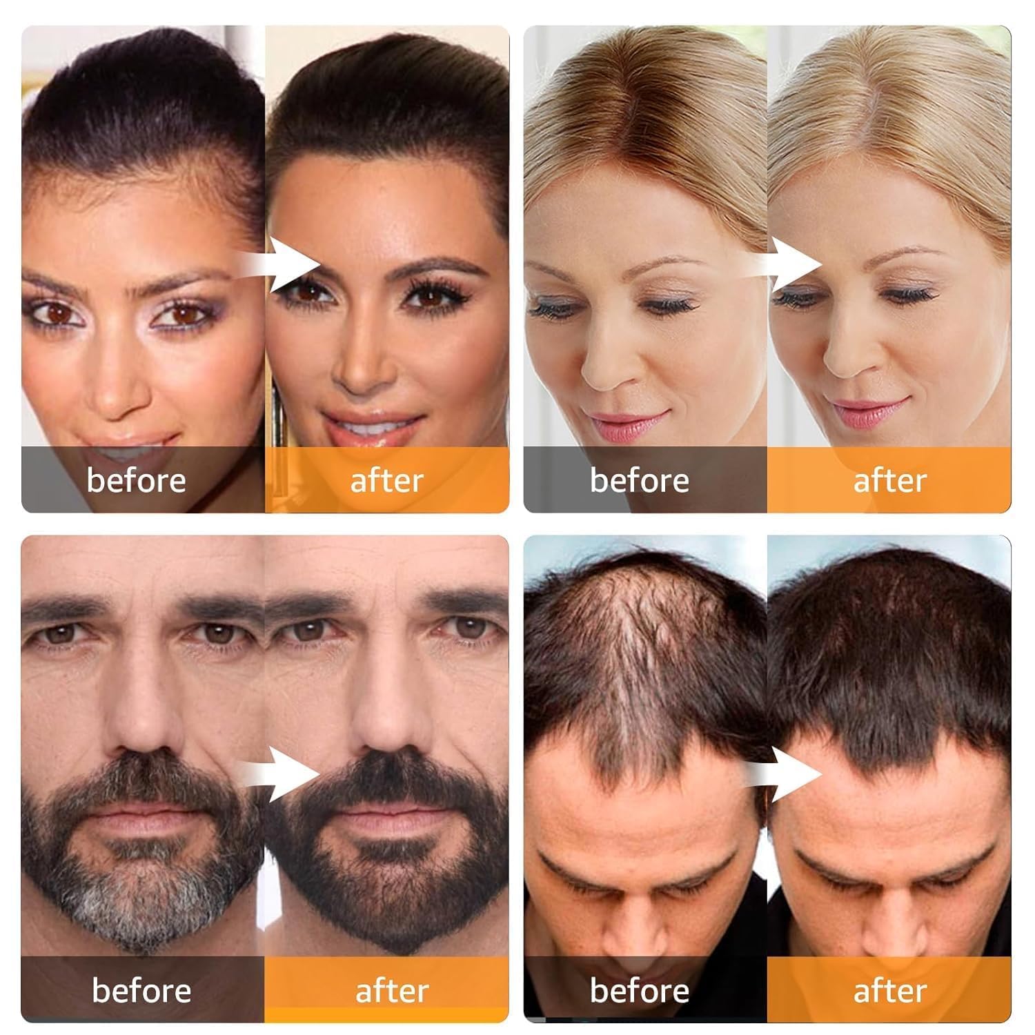 Natural Hairline Powder & Shading Sponge Pen - Quick Root Touch-Up, Eyebrow Stamp & Hairline Shadow Powder Stick (40G) - Perfect for Covering Gray Roots, Thinning Hair & Creating Fuller Hairlines at Home or On-The-Go