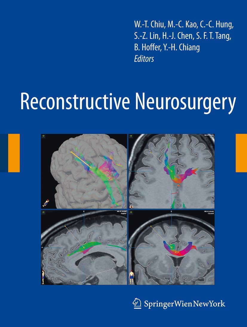 Reconstructive Neurosurgery Textbook - Acta Neurochirurgica Supplement 101 | Advanced Brain Surgery Techniques for Medical Professionals & Students | Perfect for Neurosurgery Training & Research