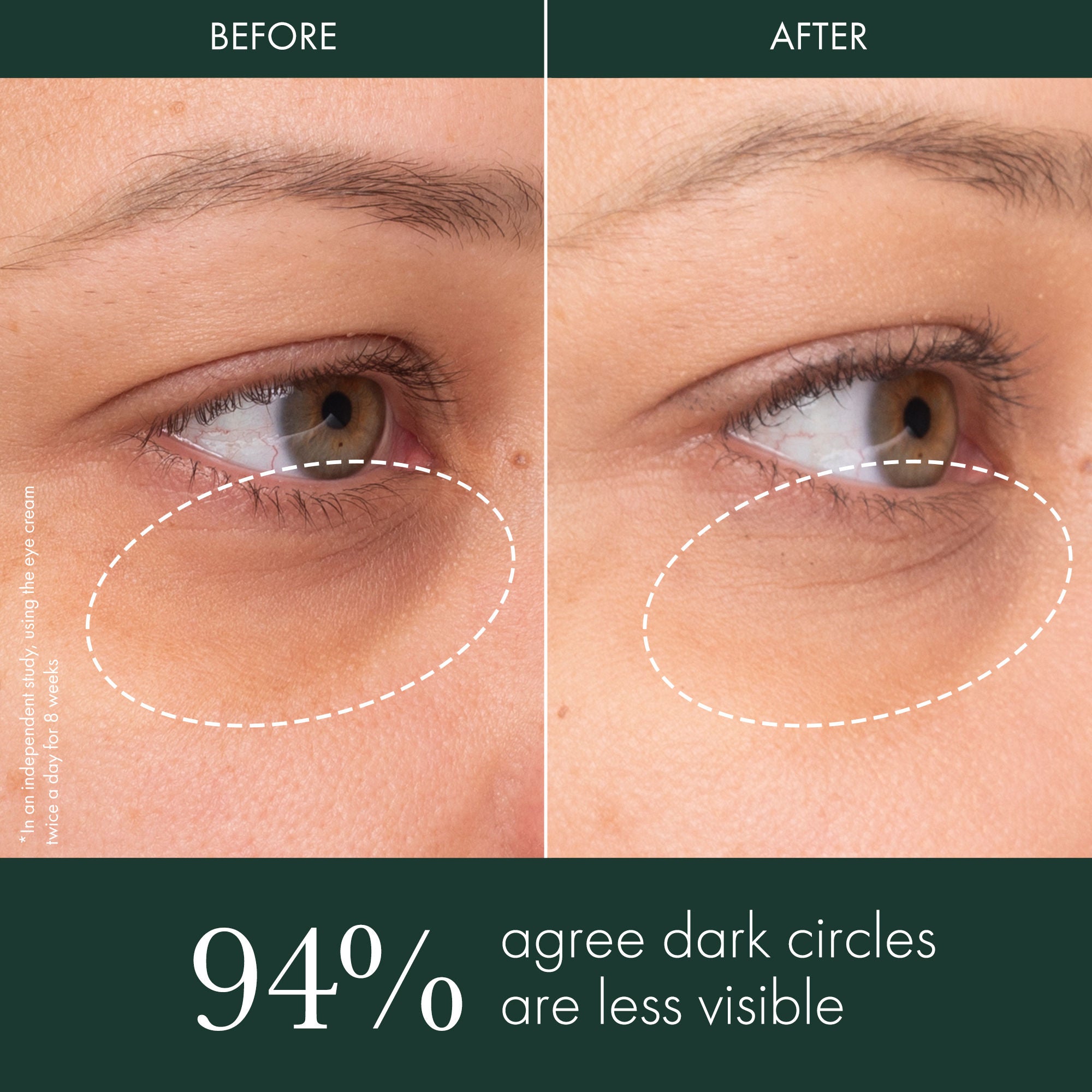 Brightening Eye Cream for Dark Circles & Puffiness - Under Eye Illuminator & Dark Circle Treatment - Perfect for Nighttime Skincare Routine & Morning Refresh