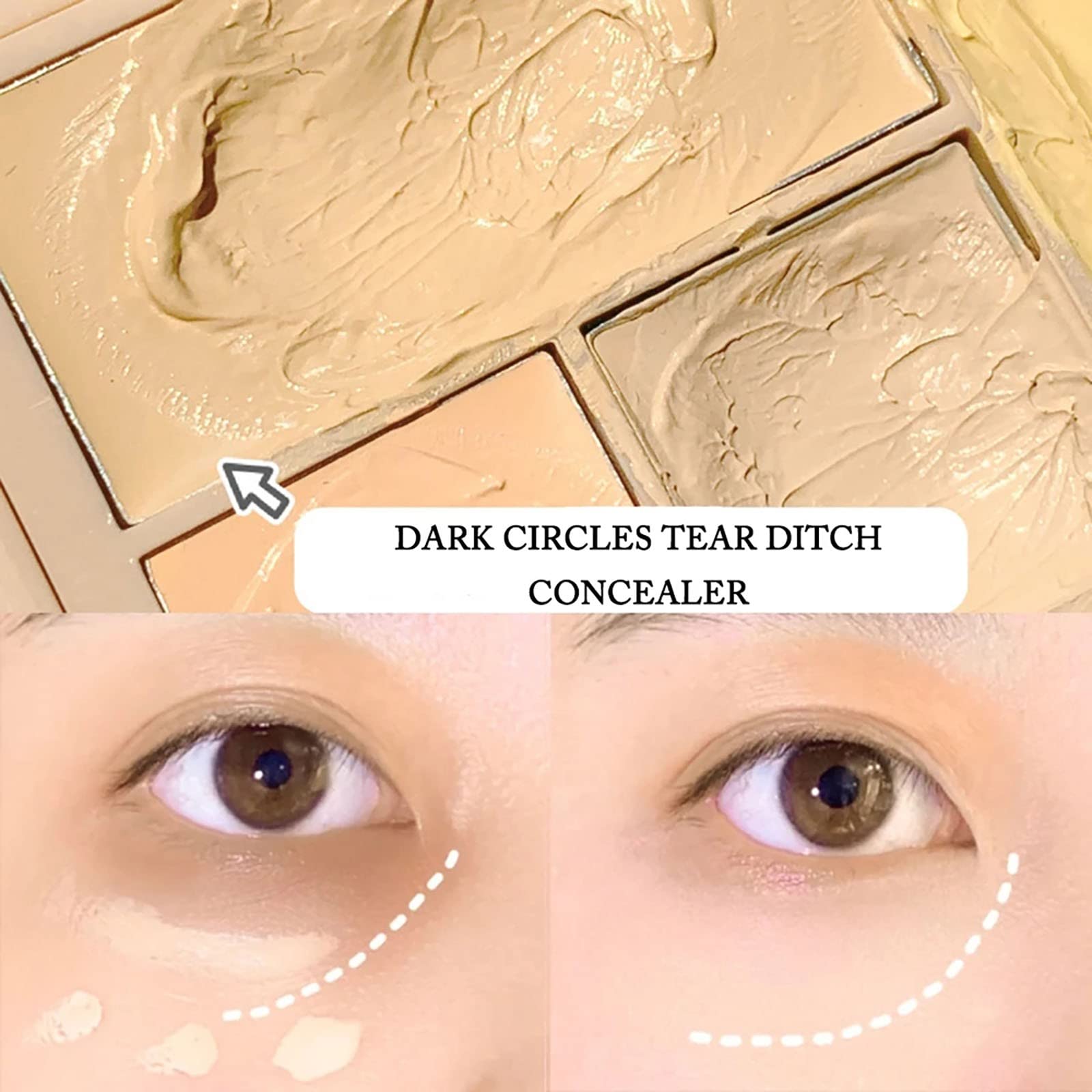 Full Coverage Concealer Makeup for Birthmarks, Scars & Skin Imperfections - 5 Colors, Long-Lasting, Waterproof - Perfect for Daily Wear, Special Occasions & Photo Shoots