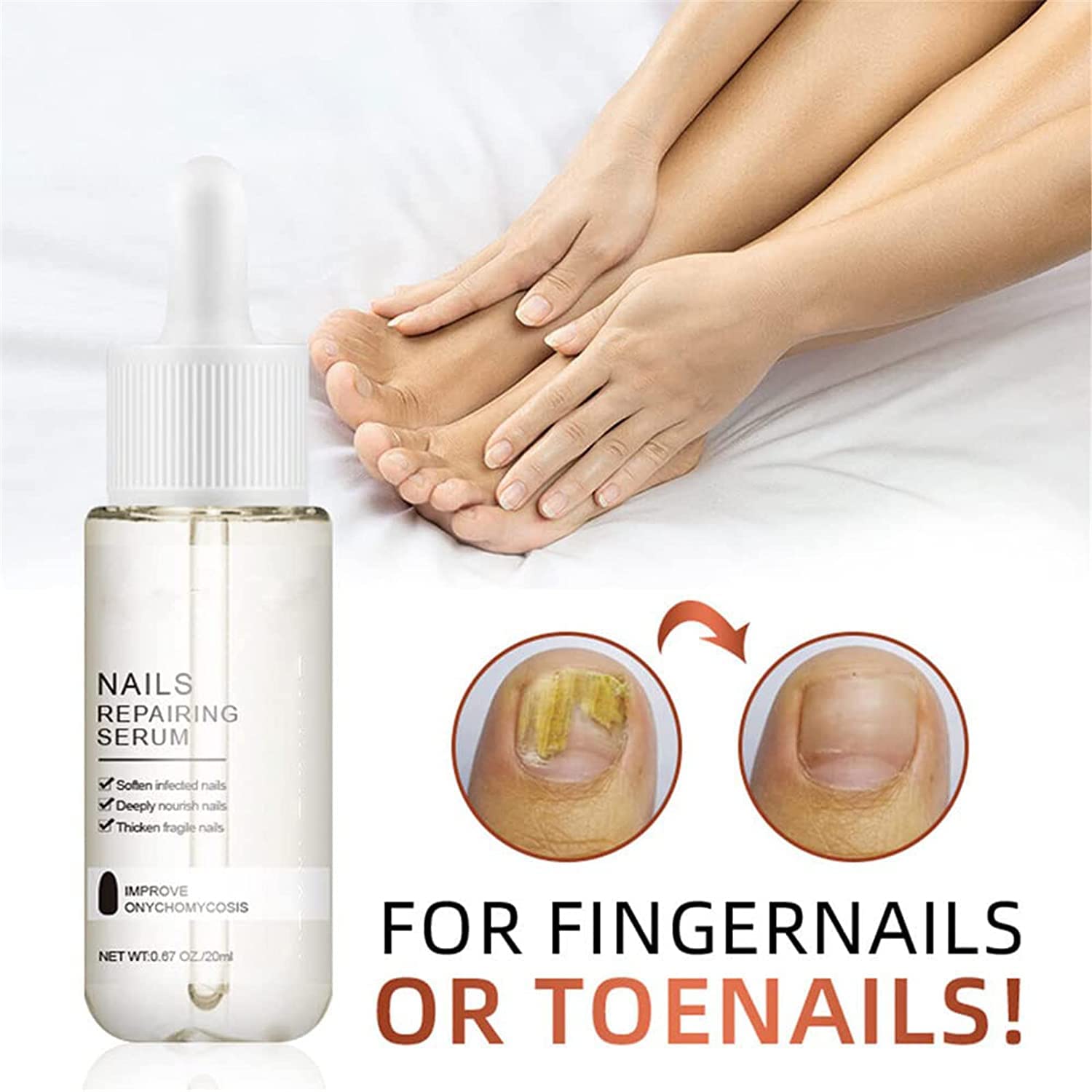 GFOUK 7 Days Nail Growth & Strengthening Serum - 20ml Fast-Acting Nail Repair Oil for Stronger, Healthier Nails - Natural Toenail Treatment for Damaged & Brittle Nails (3-Pack) - Perfect for Salon Use & At-Home Nail Care