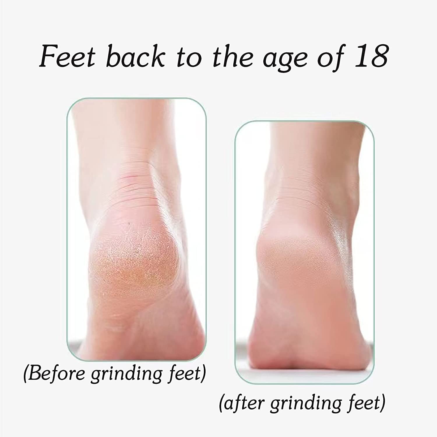 Scoovi Nano Crystal Glass Foot Grinder - Painless Callus Remover for Dry & Wet Use | Pedicure Tool for Dead Skin, Cracked Heels & Calluses | Perfect for Home Spa & Foot Care Routine