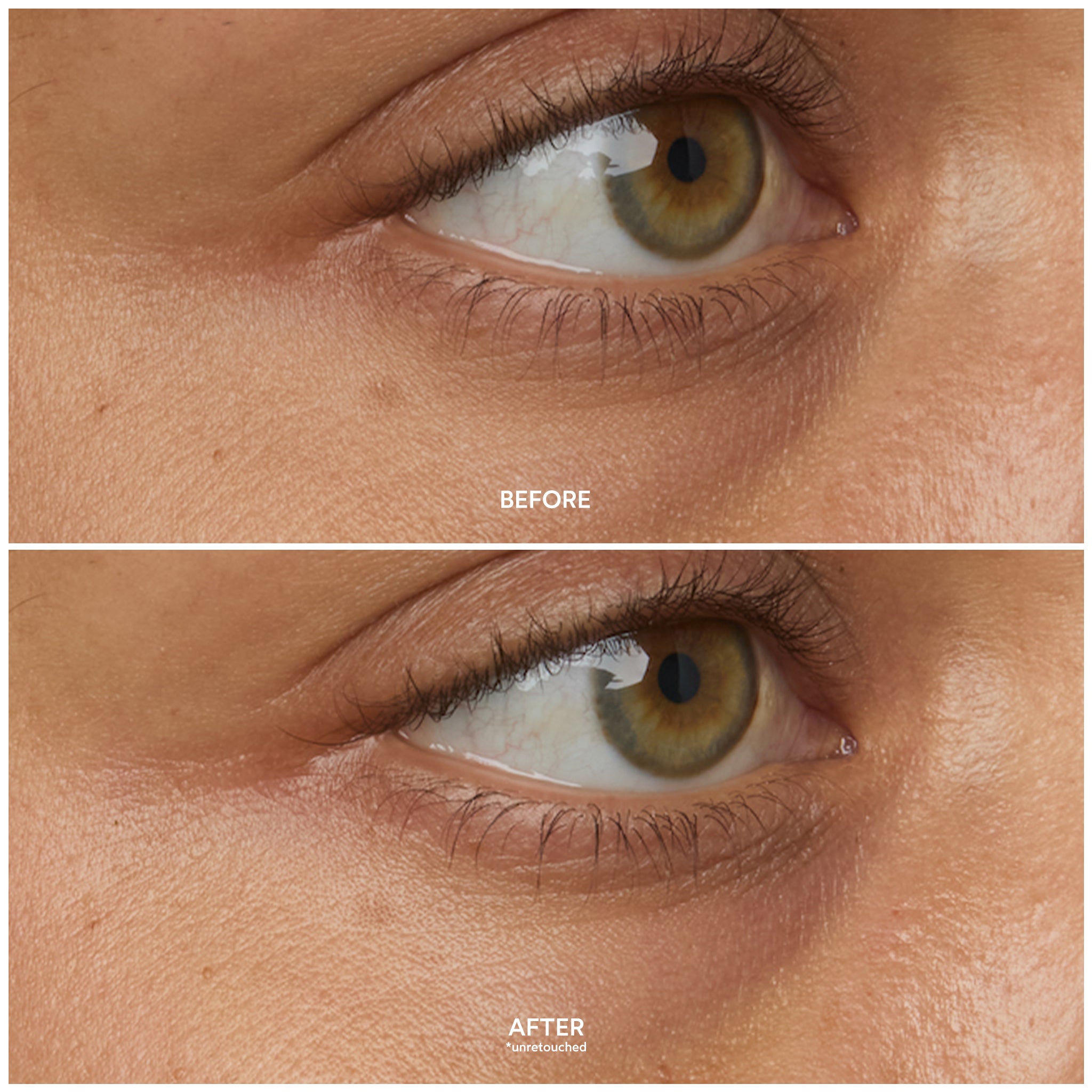 Chebula Multi Corrective Eye Patches for Dark Circles, Puffiness & Wrinkles | Anti-Aging Under Eye Treatment | Perfect for Night Routine & Travel Skincare