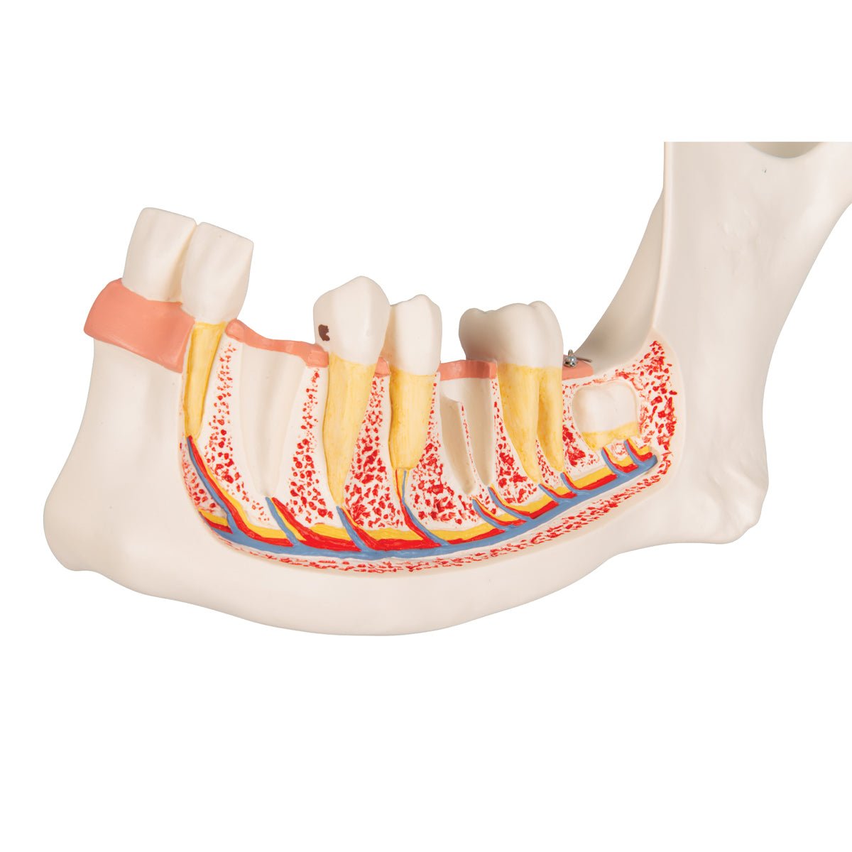 Half Lower Jaw Model - 3X Full Size, 6-Part Dental Anatomy Demonstration for Dental Students & Professionals | Perfect for Classroom Teaching & Medical Study