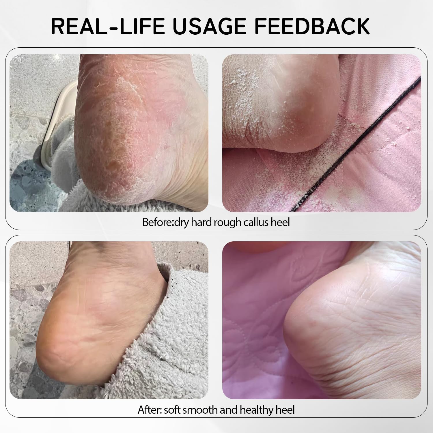 Rechargeable Electric Foot File Callus Remover - Professional Metal Pedicure Tool for Dead Skin Removal, Heel Grinder & Scraper with 60 Replacement Sandpaper Discs (Black) - Perfect for At-Home Pedicures, Soft Feet Care & Salon Quality Results