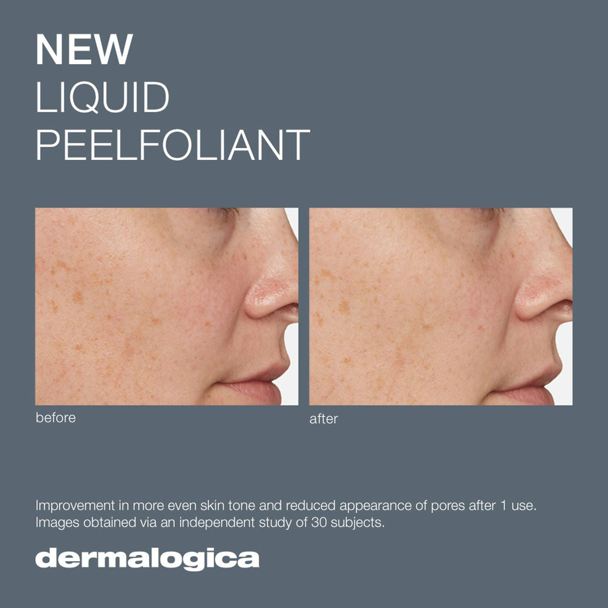 Best Liquid Peelfoliant for Glowing Skin | Exfoliating Face Peel for Smooth & Bright Complexion | Perfect for Daily Skincare Routine & Spa Treatments