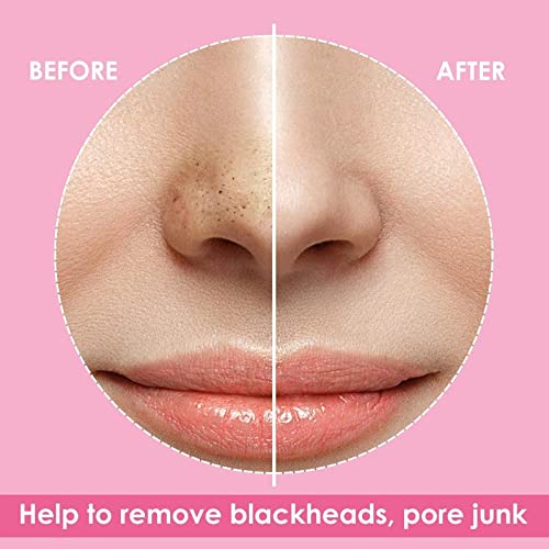 Deep Cleansing Blackhead Remover Nose Strips for Men & Women - 10 PCS Pore Cleansing Strips for Face & Nose, Salon & Home Use - Perfect for Spa Days & Skincare Routines