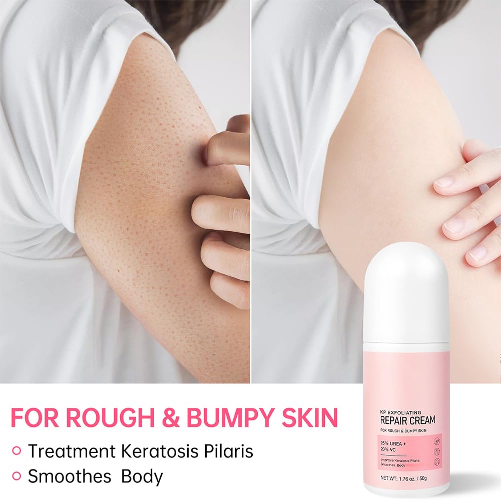 Strawberry Legs Treatment Cream for Women – 1.75 Fl Oz Bumpy Skin Body Lotion, KP Bump Eraser & Exfoliating Scrub for Keratosis Pilaris – Hydrating & Smoothing Body Care Cream for Dry, Rough Skin – Perfect for Daily Use & Post-Shaving Routine